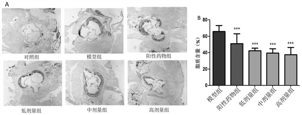 Application of radix angelicae pubescentis extract in preparation of medicine for treating and/or preventing atherosclerosis