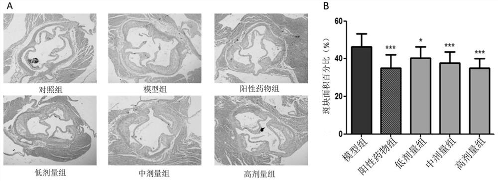 Application of radix angelicae pubescentis extract in preparation of medicine for treating and/or preventing atherosclerosis