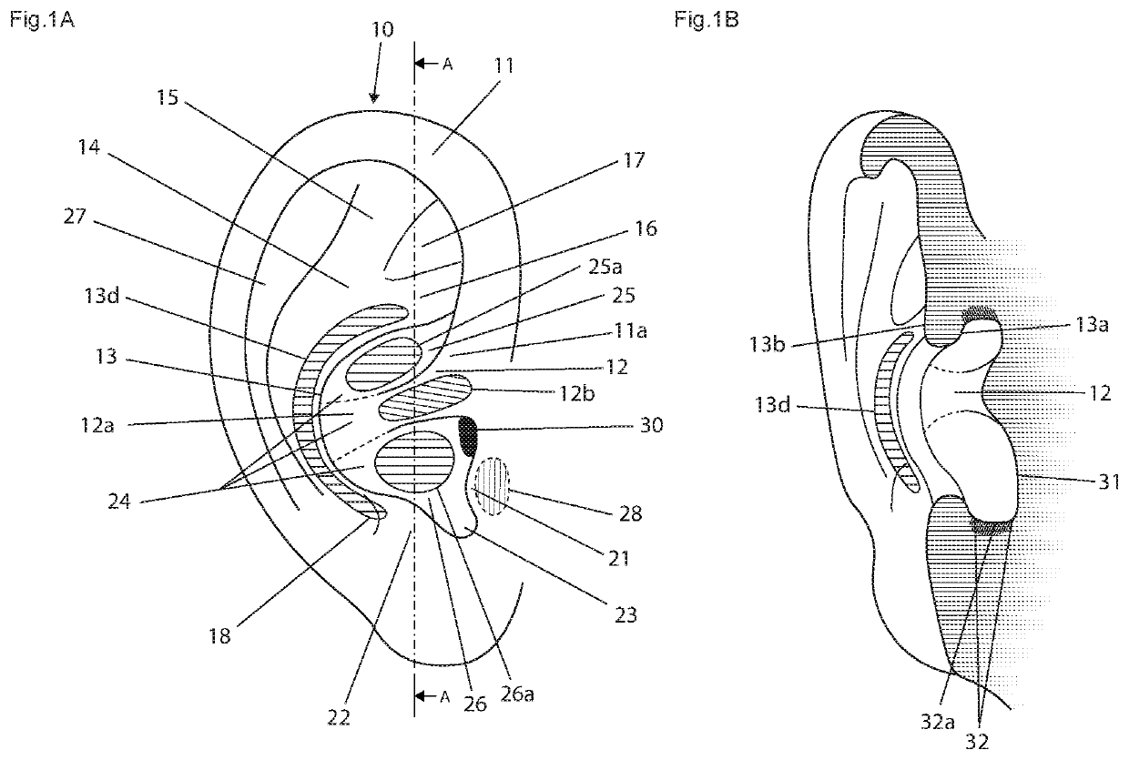 Skirt attachment