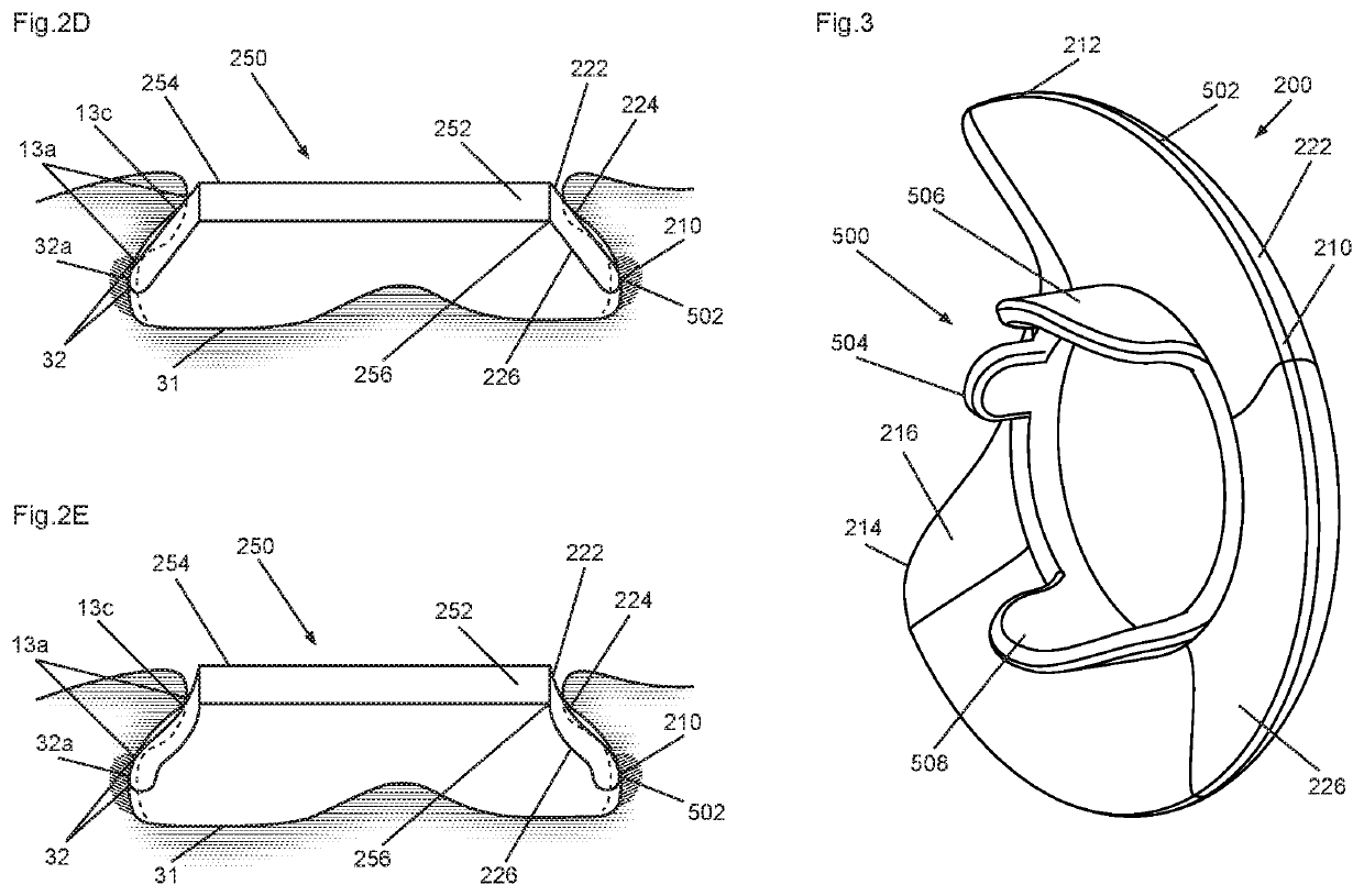 Skirt attachment