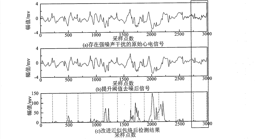 Electrocardiosignal characteristic detection algorithm