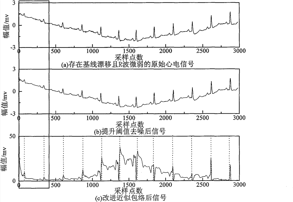 Electrocardiosignal characteristic detection algorithm