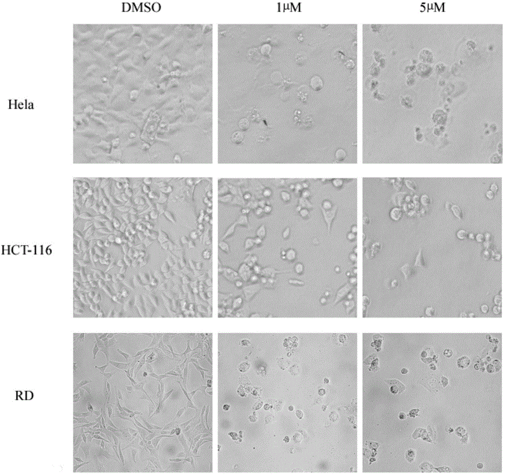 Application of thiazolidone derivative in preparing anti-rhabdomyosarcoma medicines