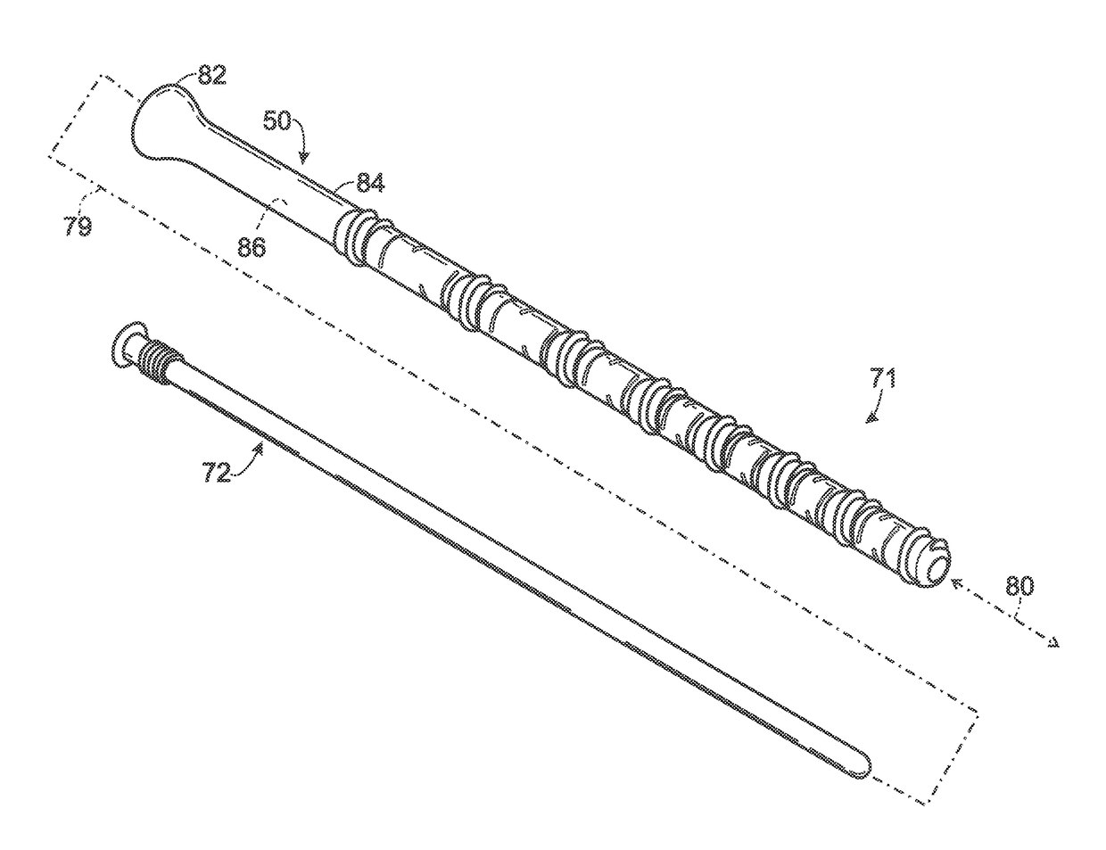 Steerable fastener for bone