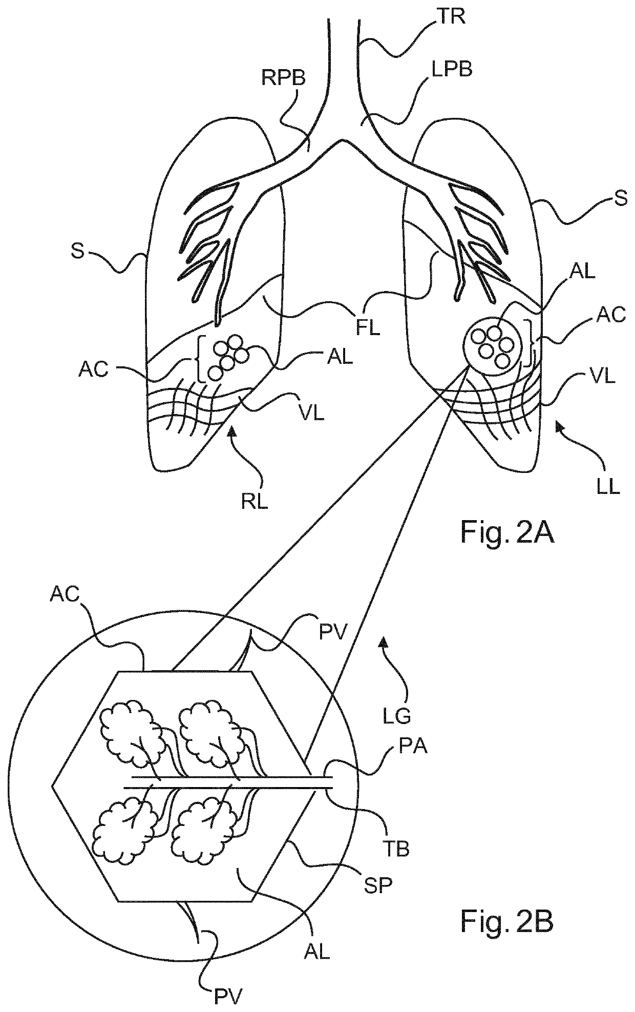 Image processing system and method