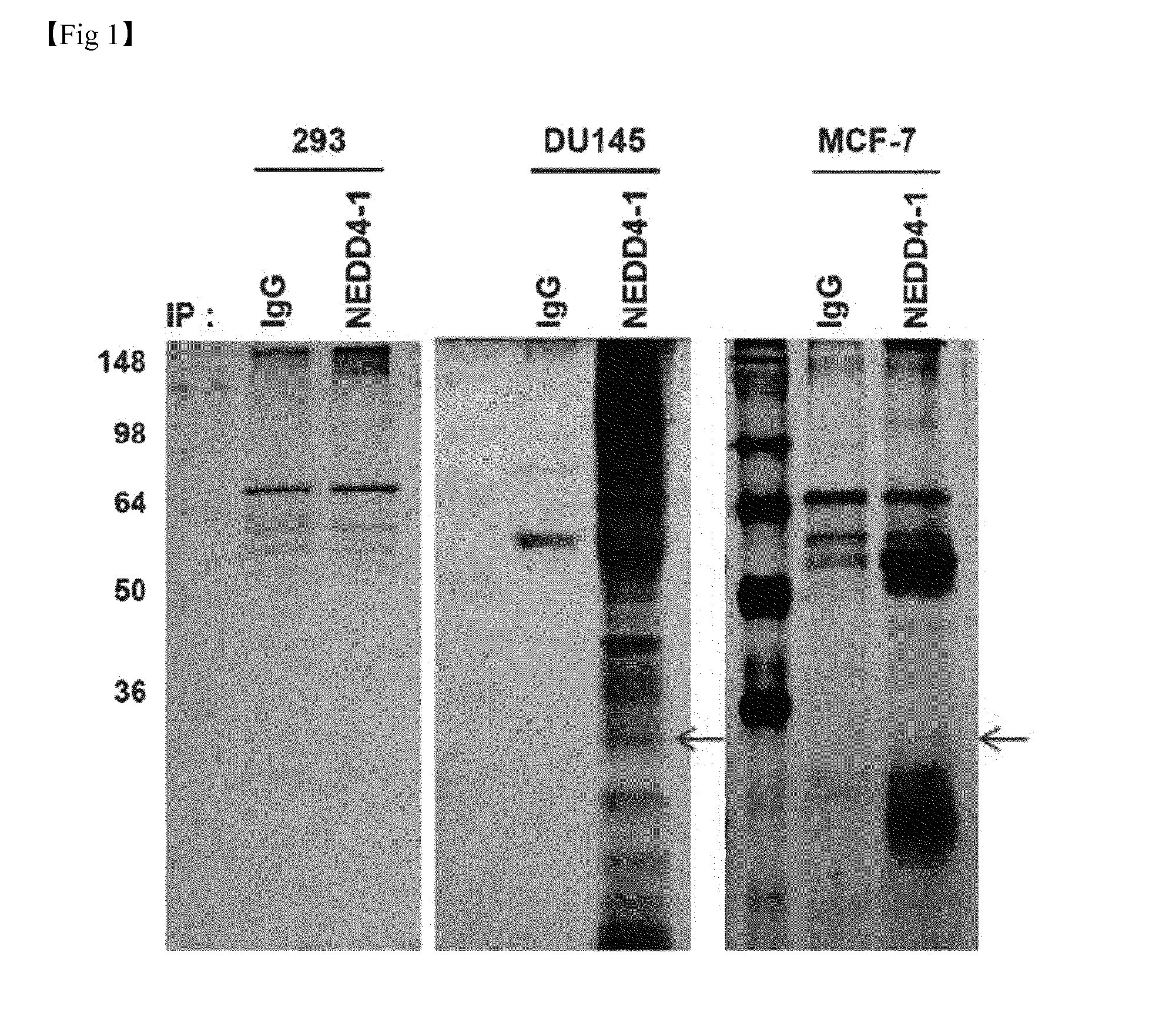 Composition for Treatment or Metastasis Suppression of Cancers Which Includes P34 Expression Inhibitor or Activity Inhibitor as Active Ingredient