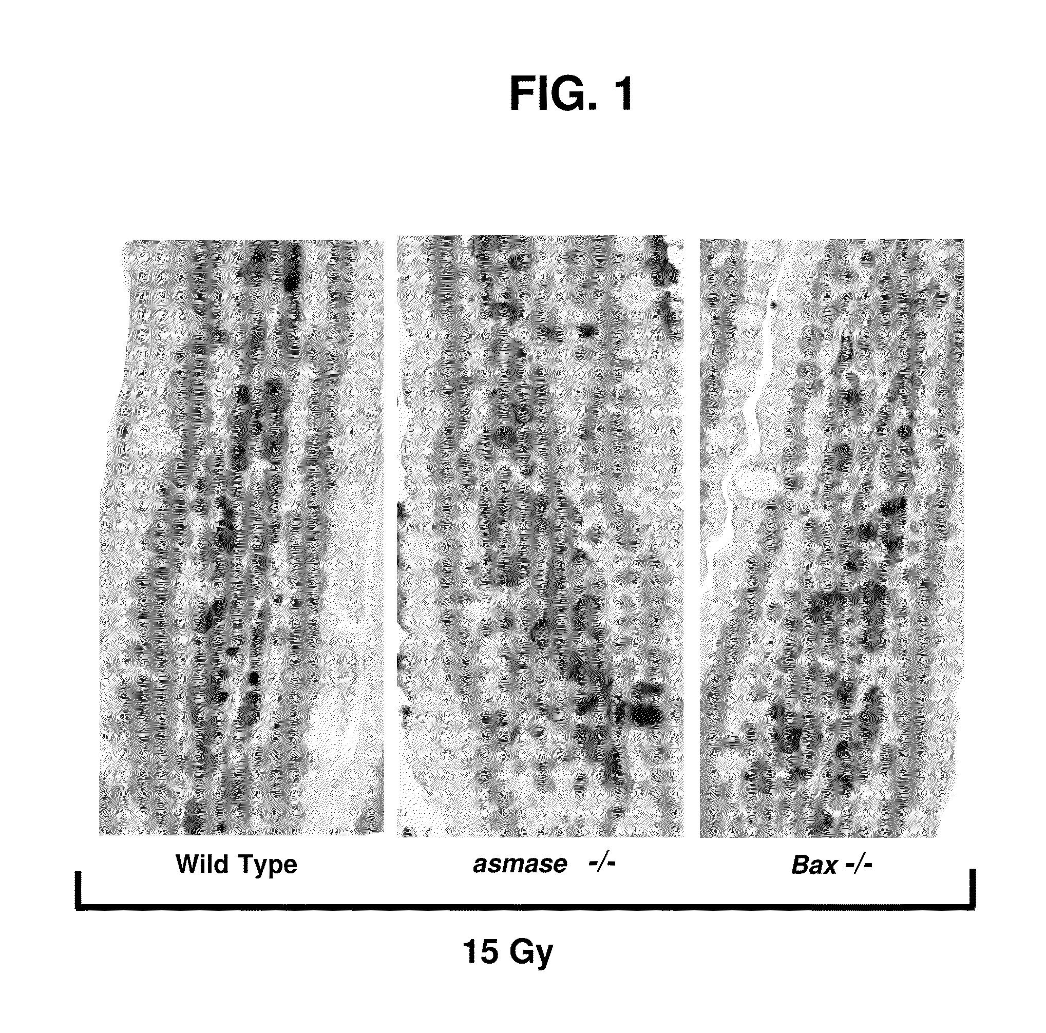 Methods for treating GI syndrome and graft versus host disease