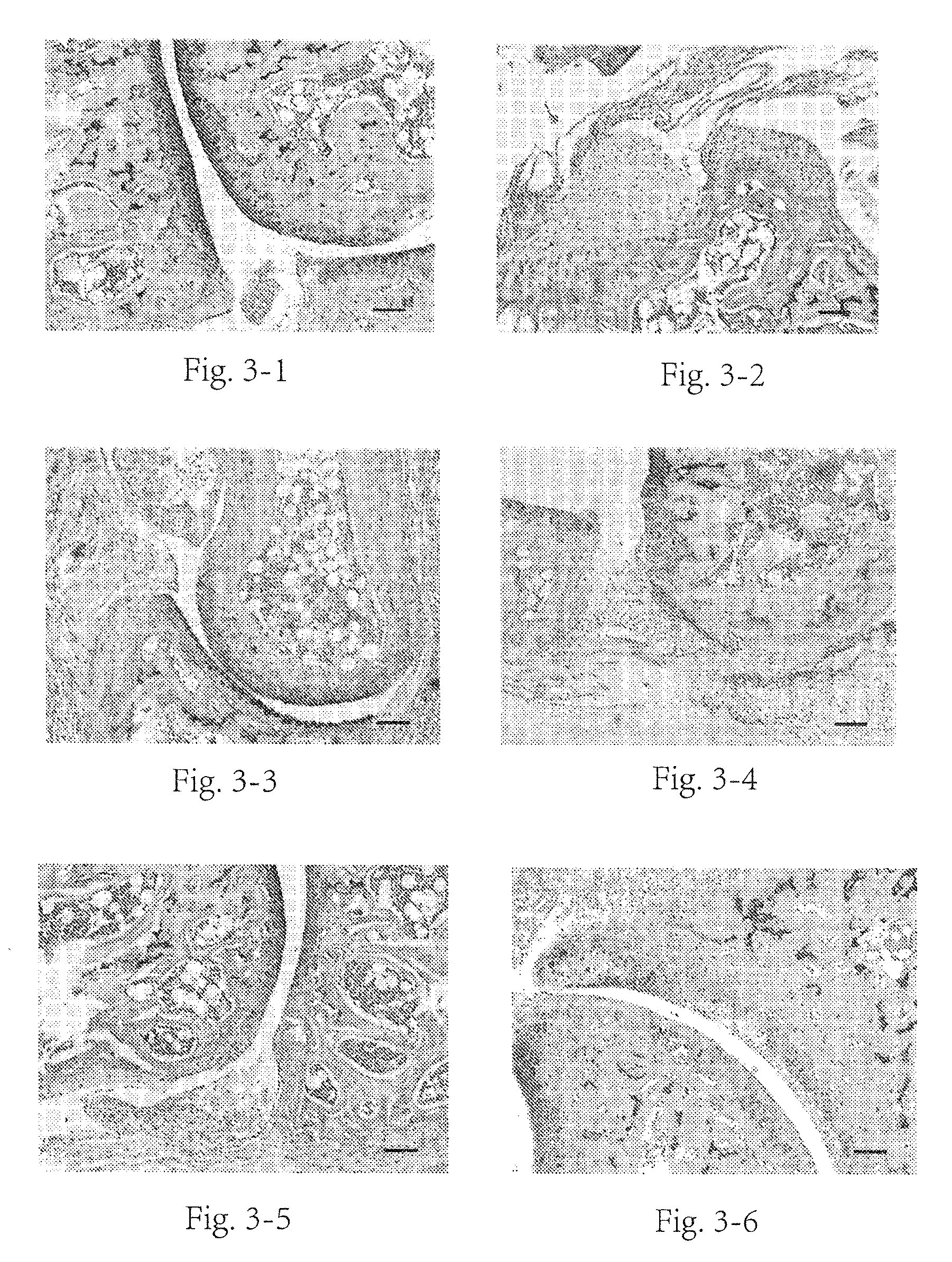 Use of koumine and its homologues in preparation of medicament for treatment of autoimmune diseases of involved bones and joints