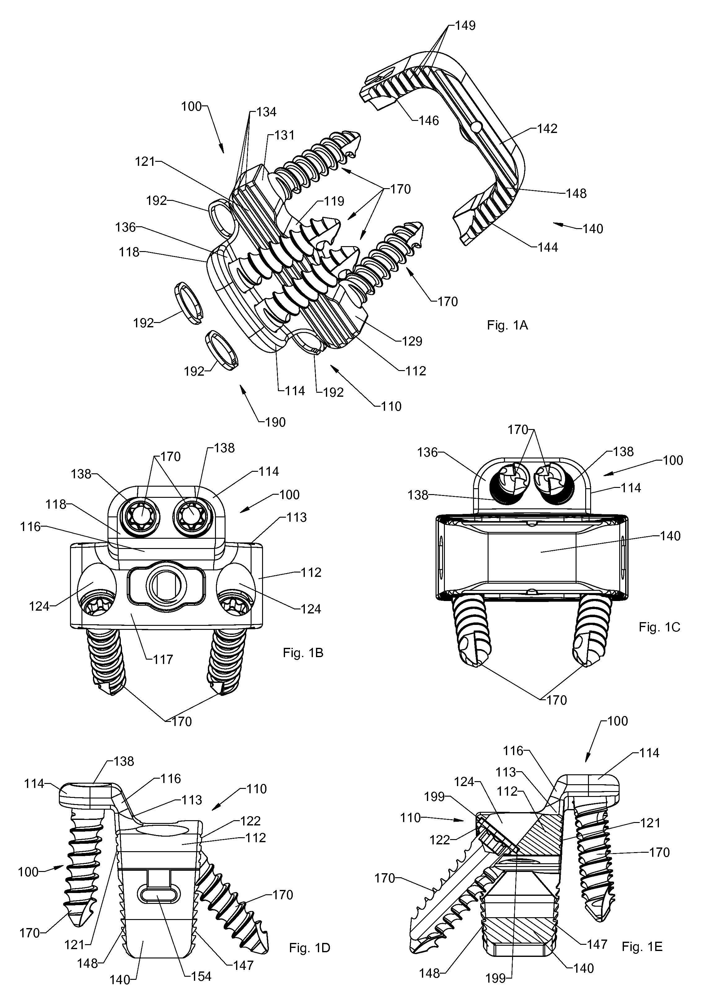 Spinal implants, spinal implant kits, and surgical methods