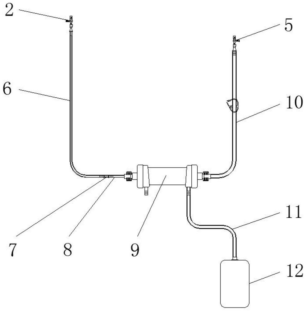 Novel extracorporeal circulation ultrafiltration pipeline