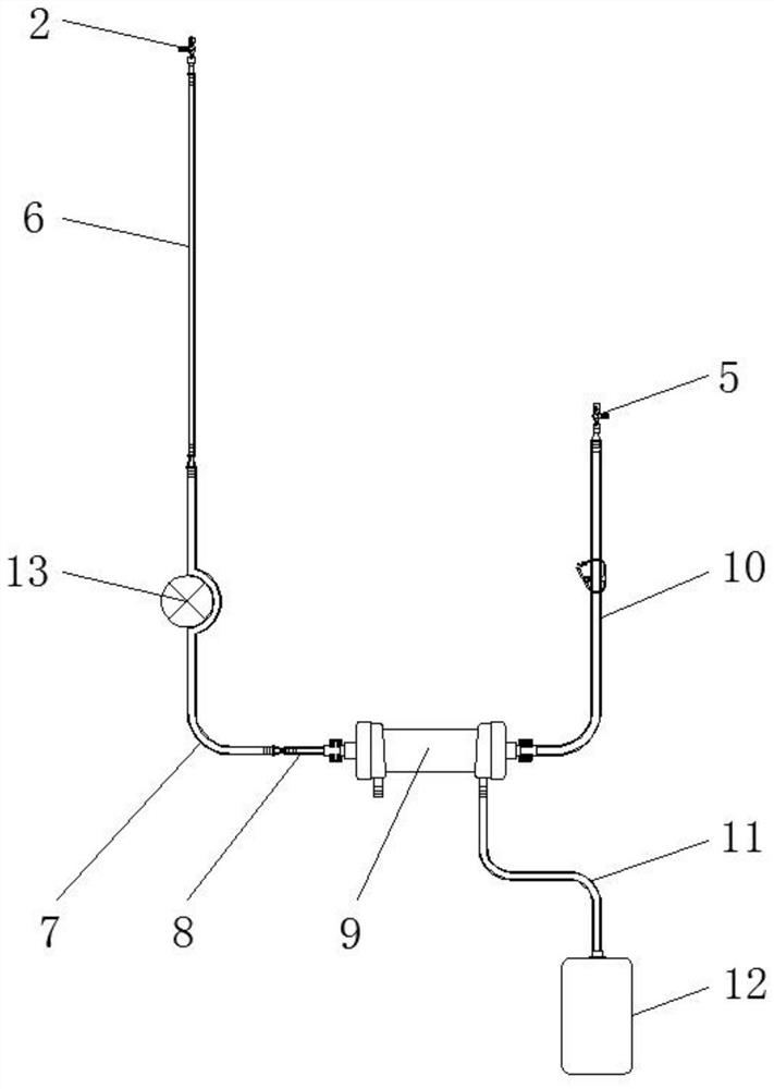 Novel extracorporeal circulation ultrafiltration pipeline