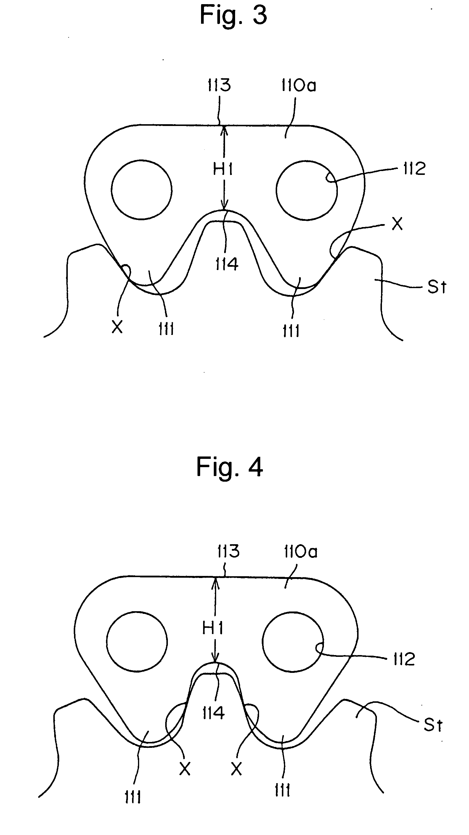 Double-sided engagement type silent chain