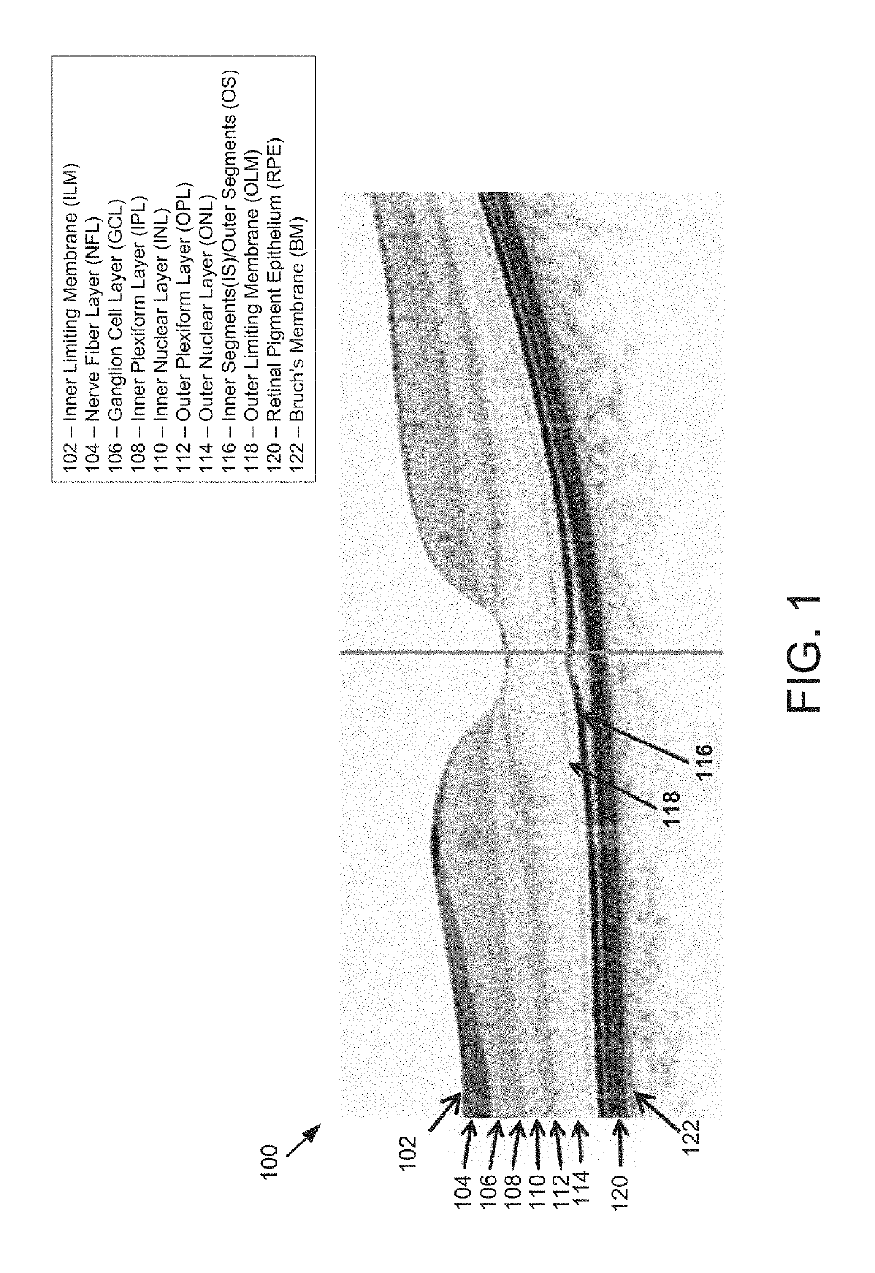 Methods and systems to detect and classify retinal structures in interferometric imaging data