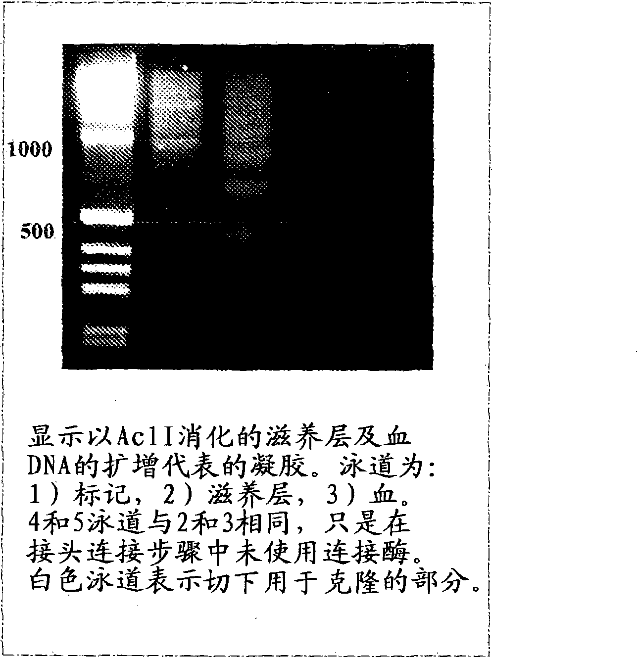 Specific amplification of fetal DNA sequences from a mixed, fetal-maternal source