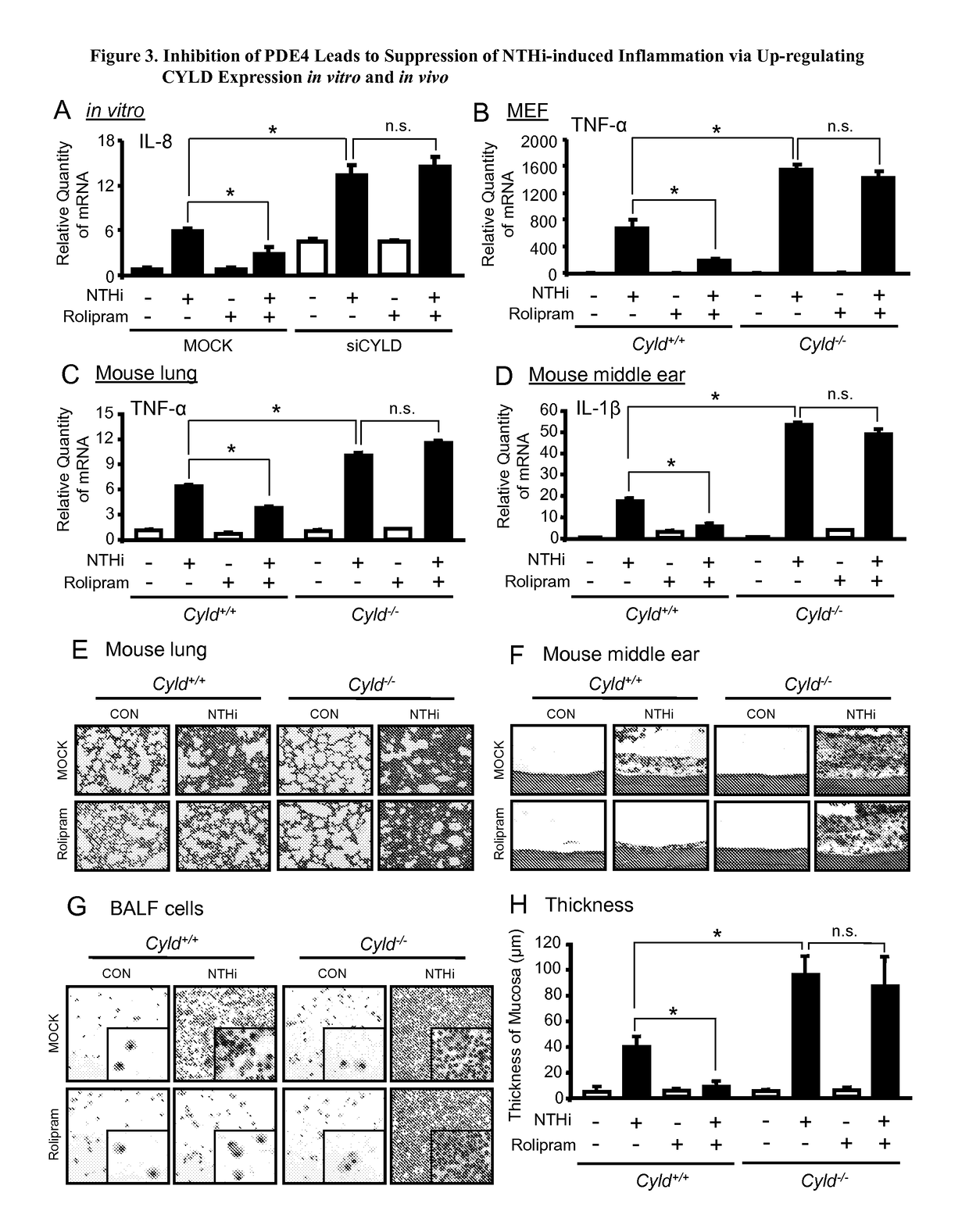 Compositions and methods for treating otitis media and other conditions with inhibitors of CYLD