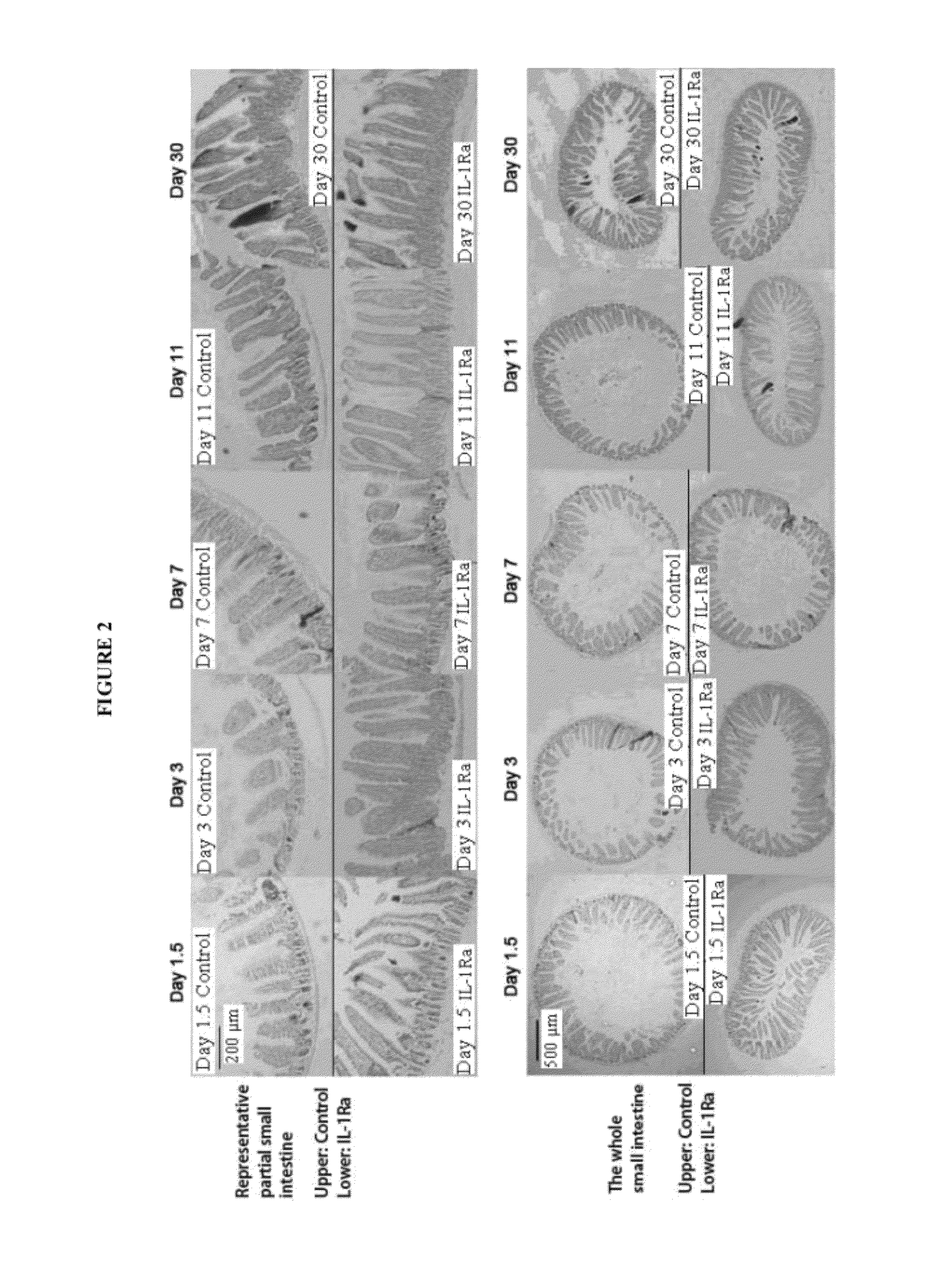 Methods for treating epithelium trauma of the intestinal mucosa using interleukin-1 receptor antagonist