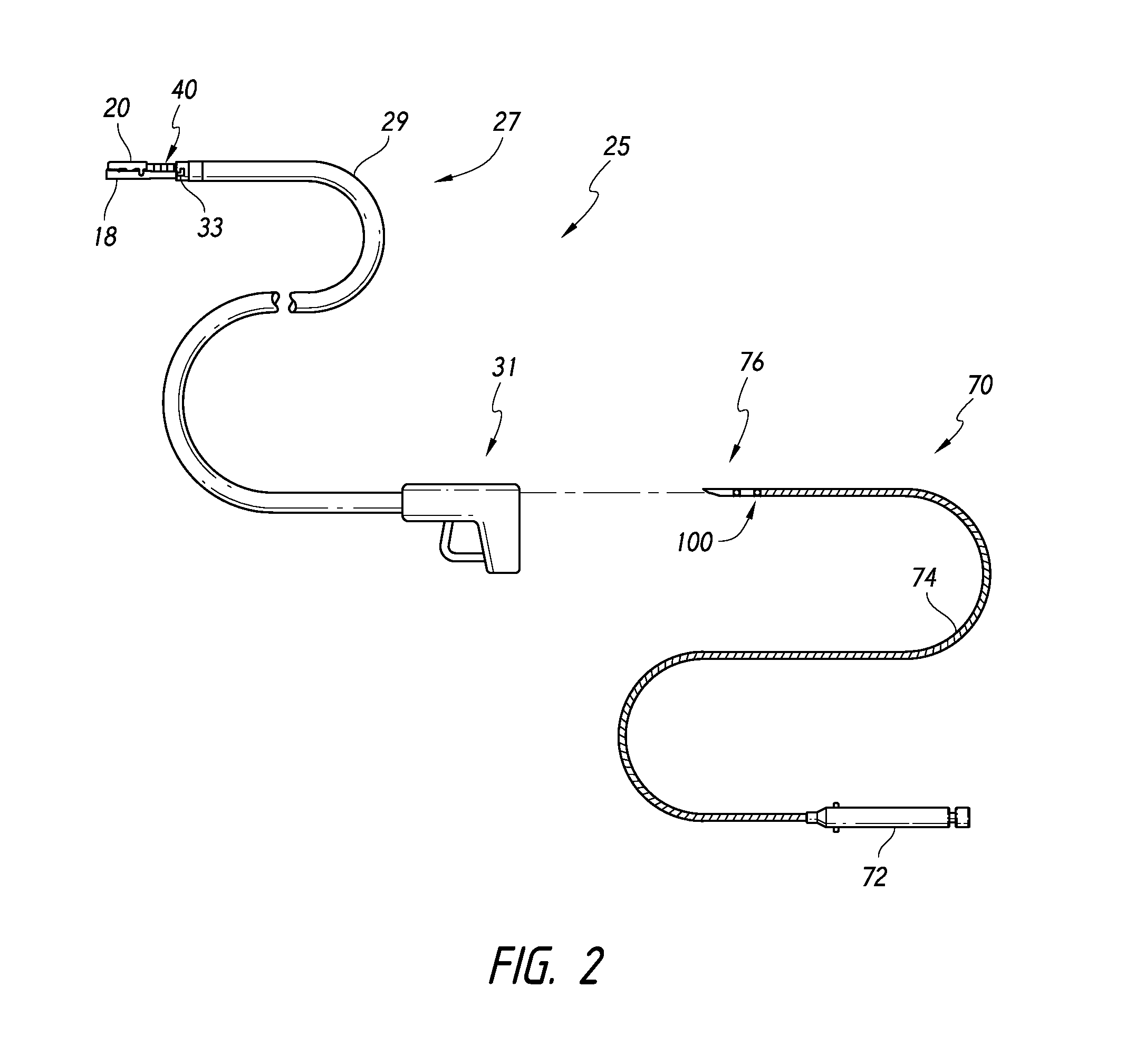 Devices and methods for the endolumenal treatment of obesity