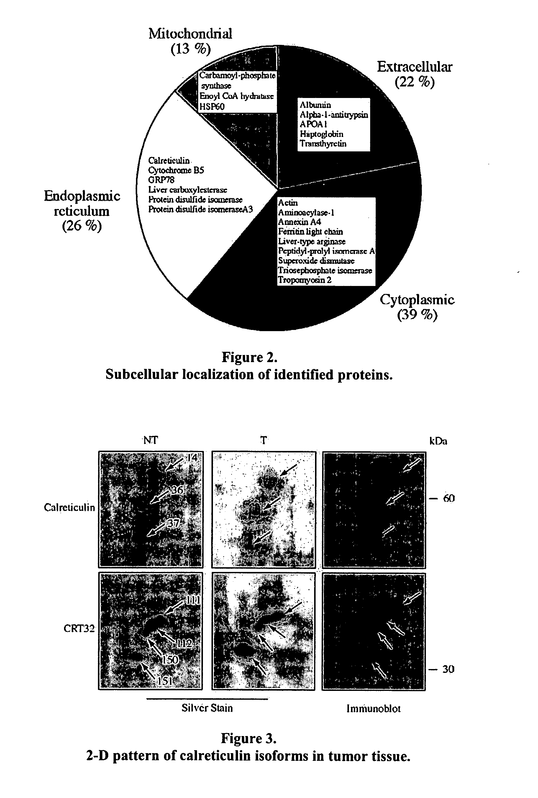 Liver cancer biomarkers