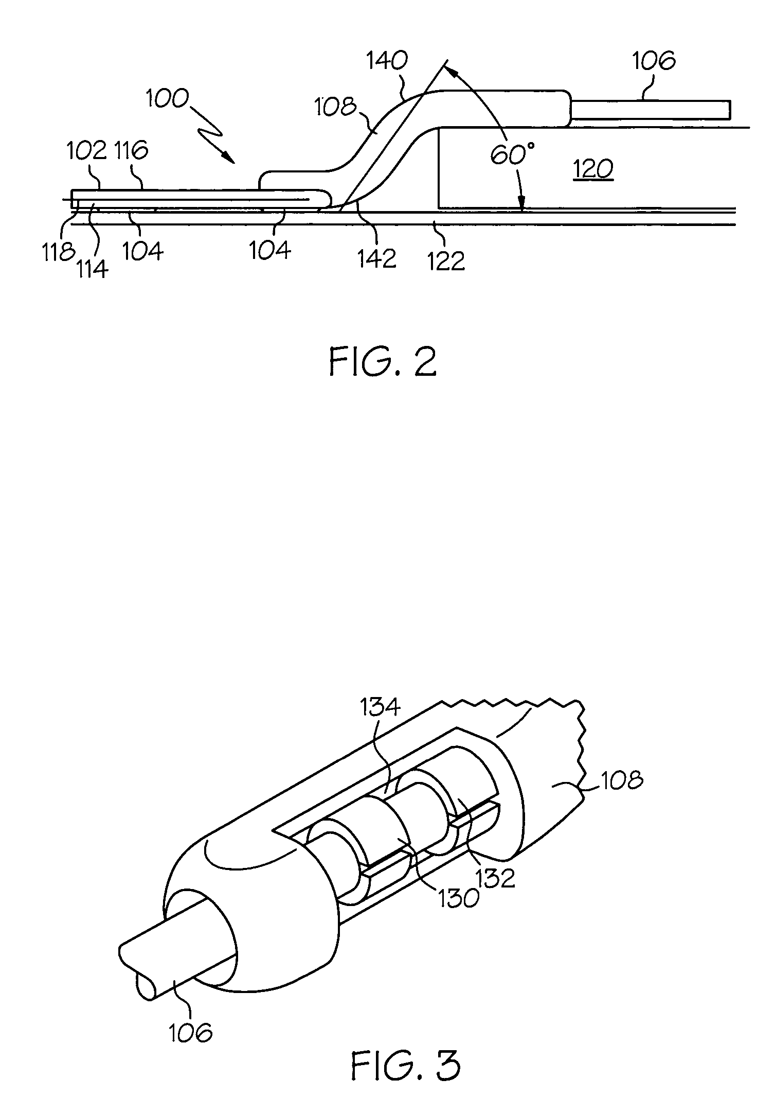 Implantable cortical neural lead and method