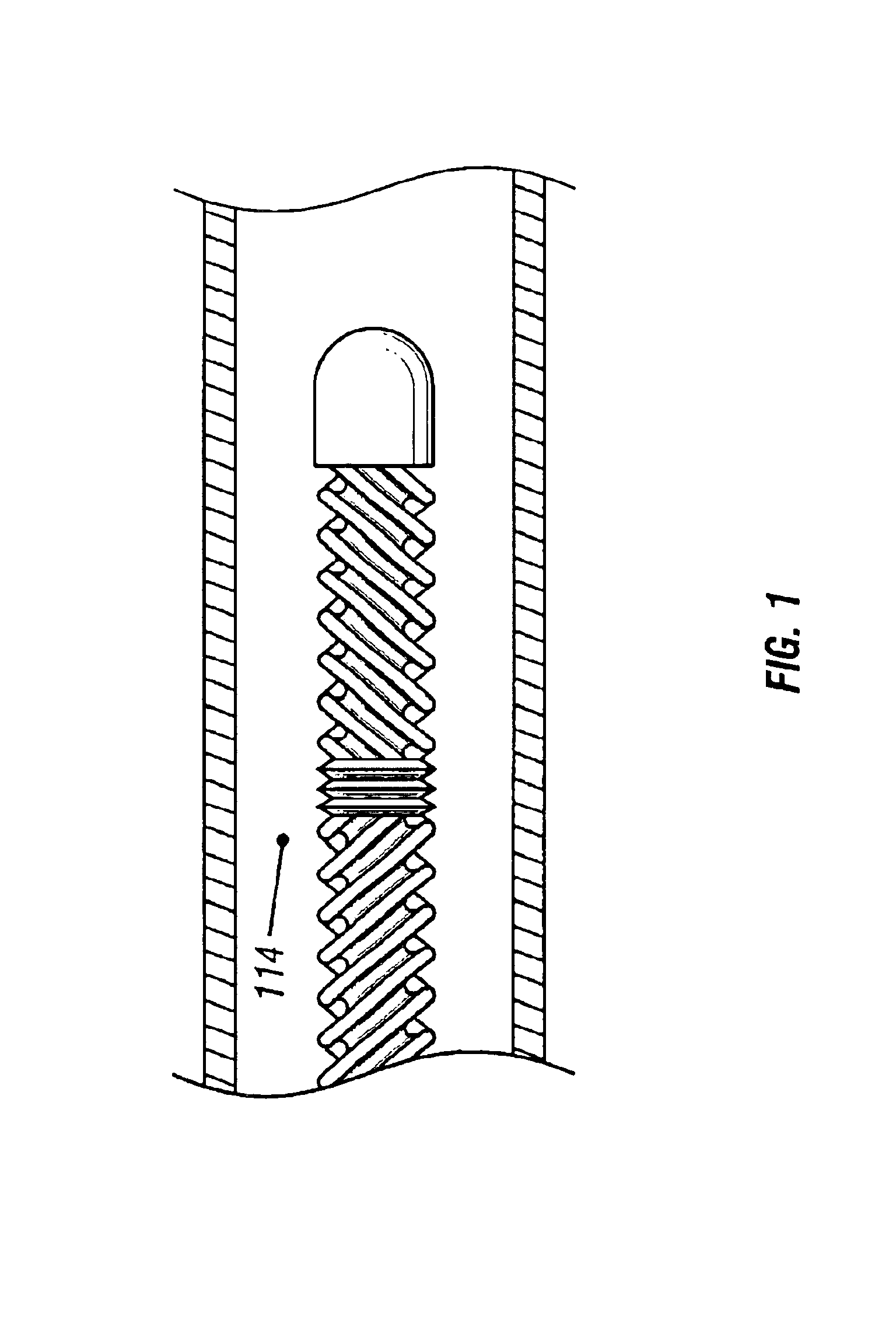 Selective organ cooling catheter with guidewire apparatus and temperature-monitoring device