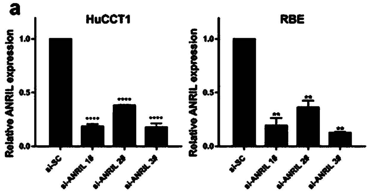 Application of long-chain non-coding RNA and compositions thereof in diagnosis/treatment of cholangiocarcinoma