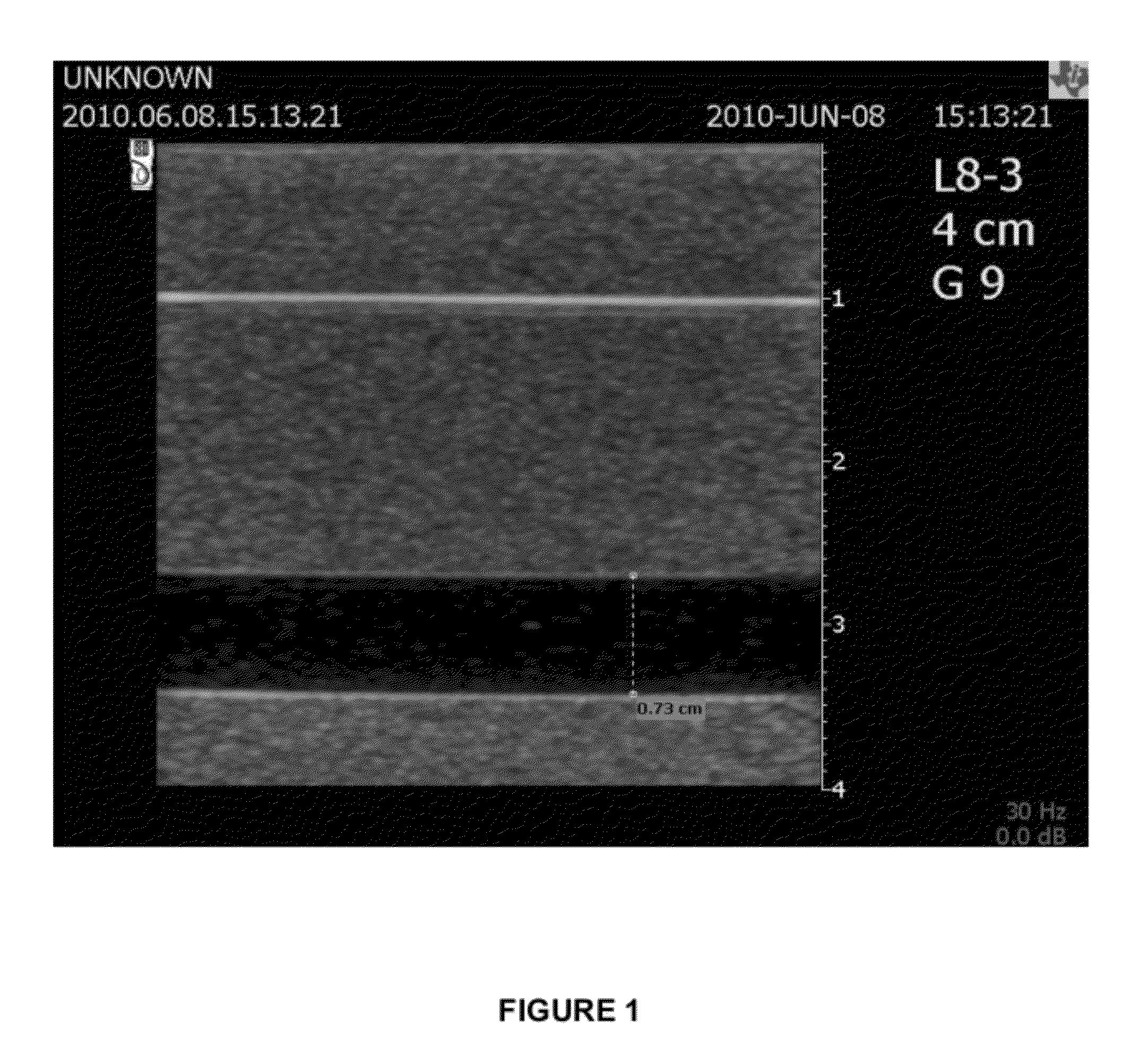 Ultrasound Image Performance Determination