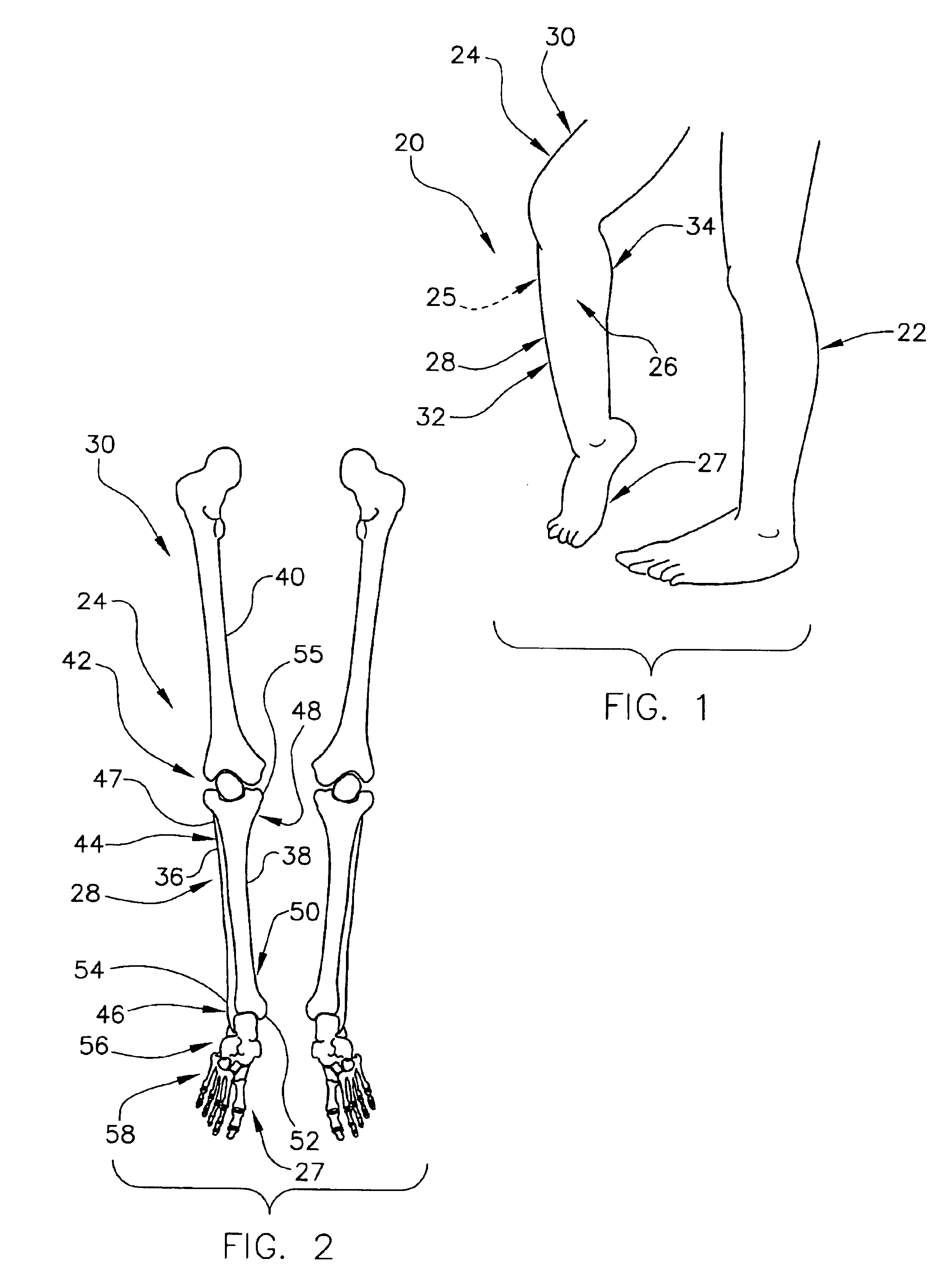 Method and apparatus for determining a dorsiflexion angle