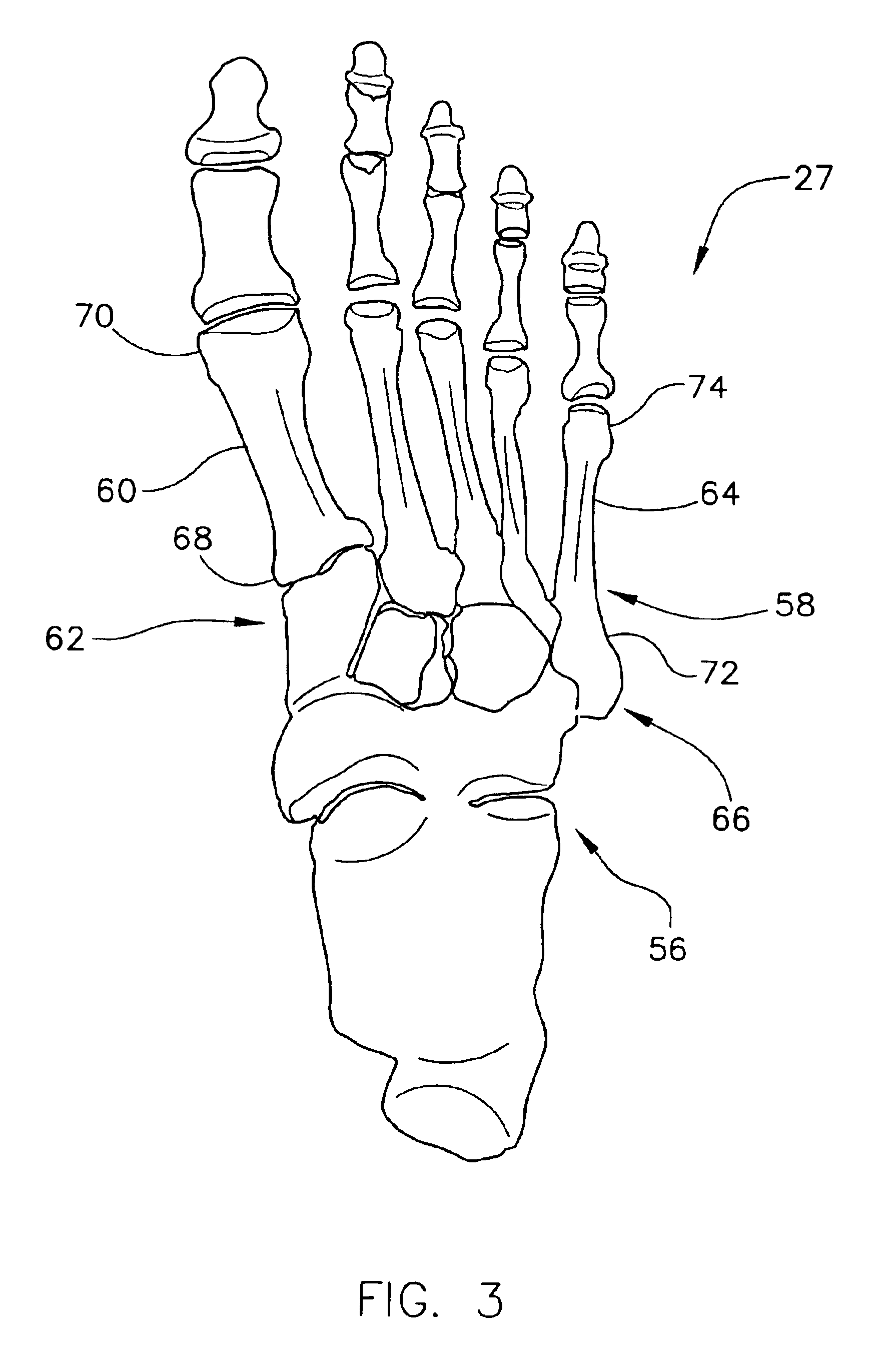 Method and apparatus for determining a dorsiflexion angle