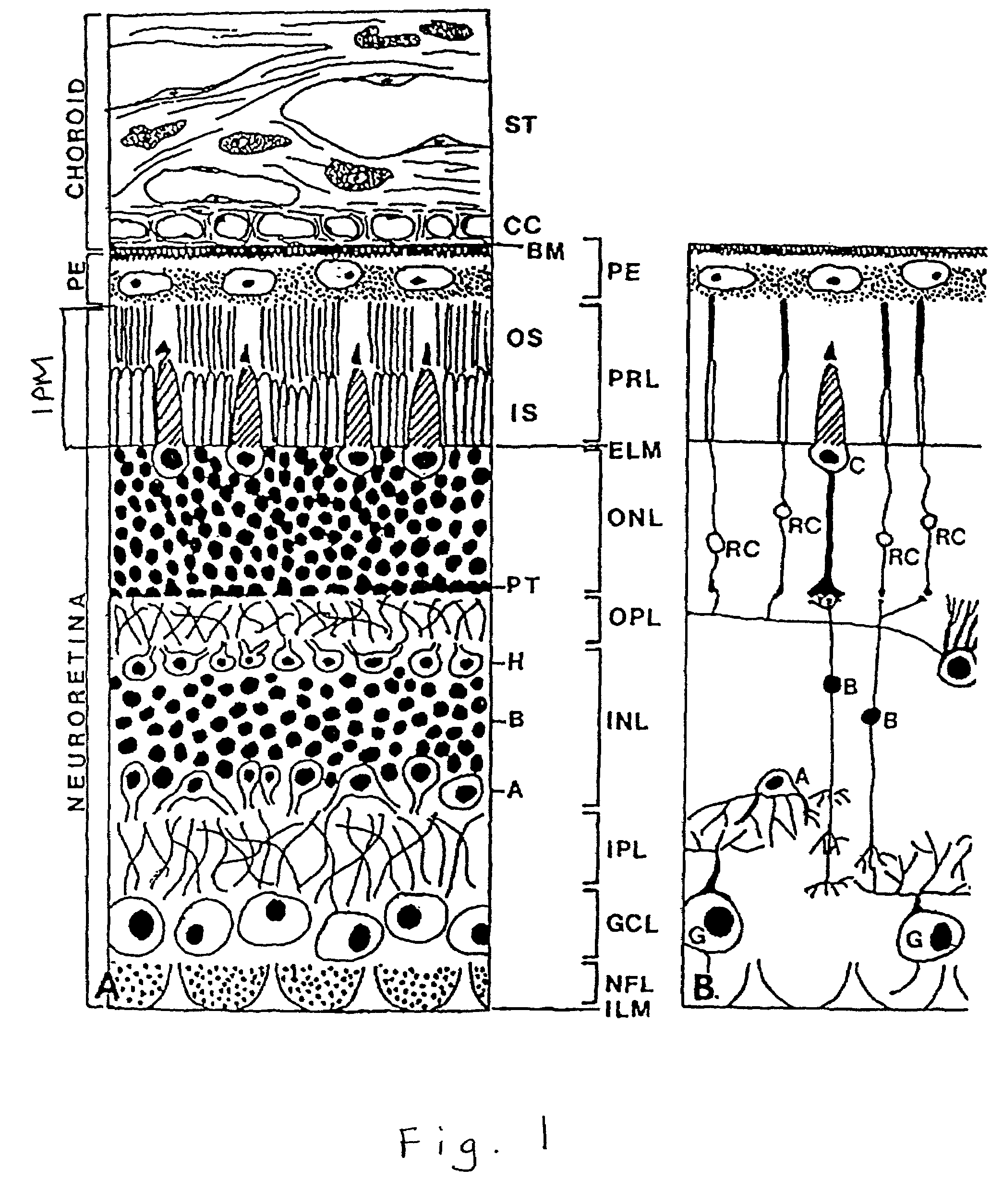 Nucleic acids encoding interphotoreceptor matrix proteins