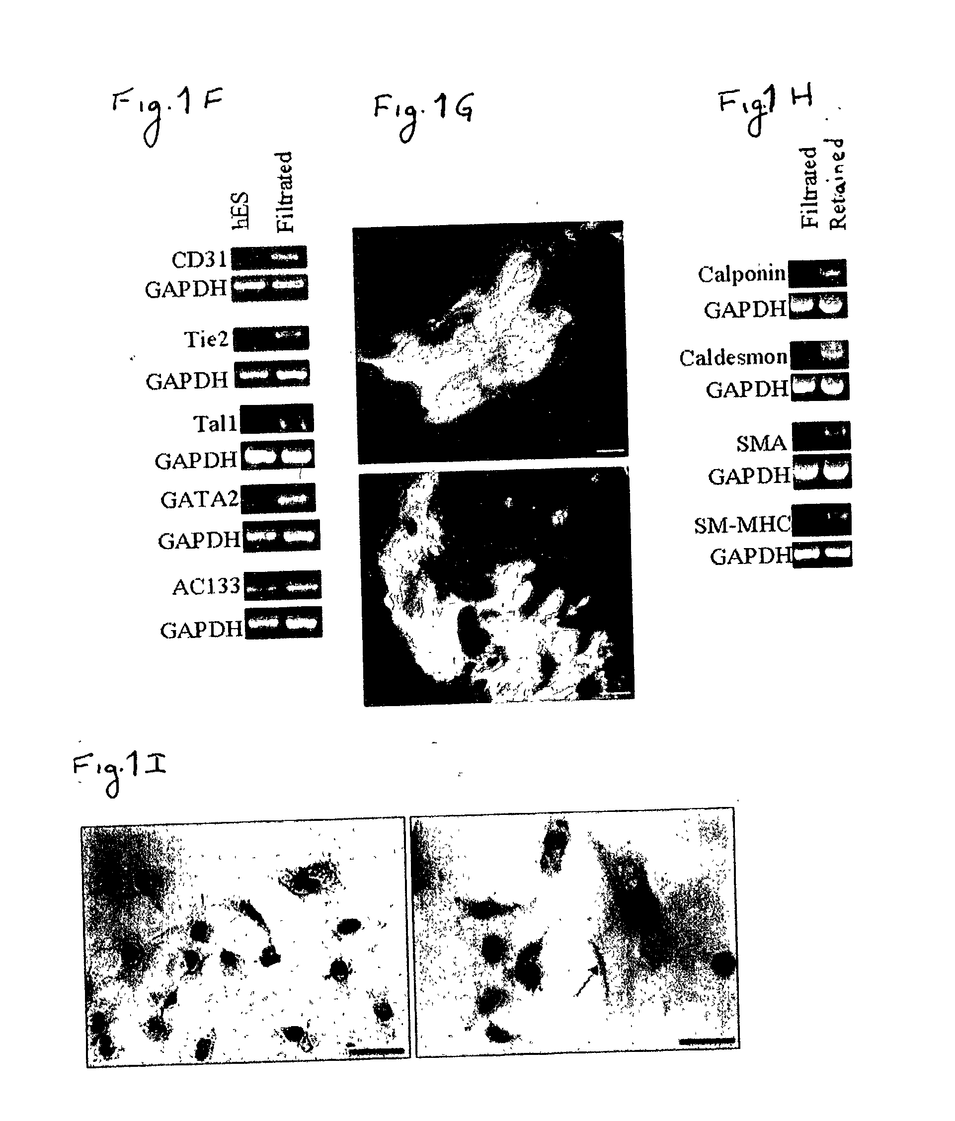 Novel methods for the in-vitro identification, isolation and differentiation of vasculogenic progenitor cells