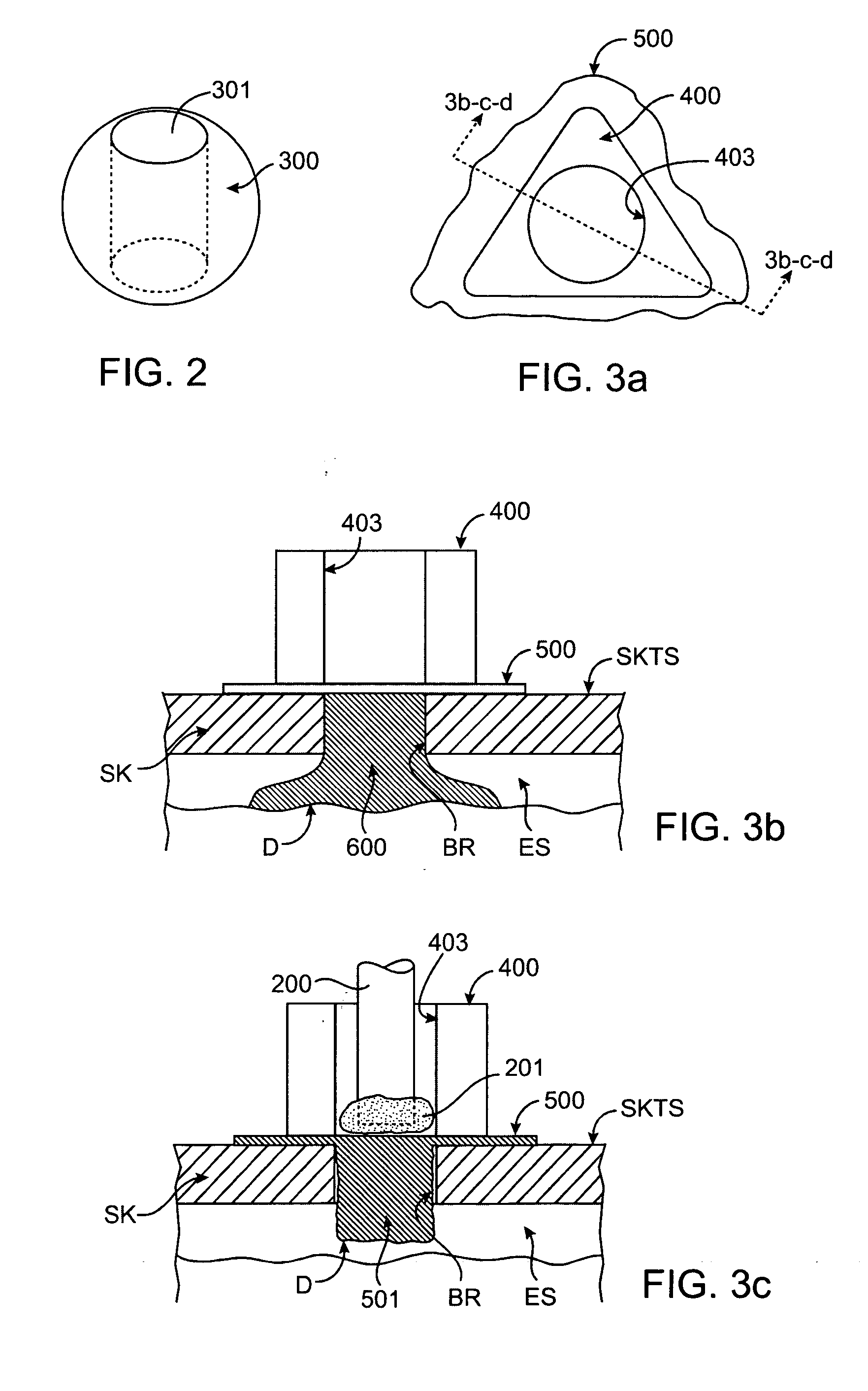 Methods and apparatus for intracranial ultrasound therapies