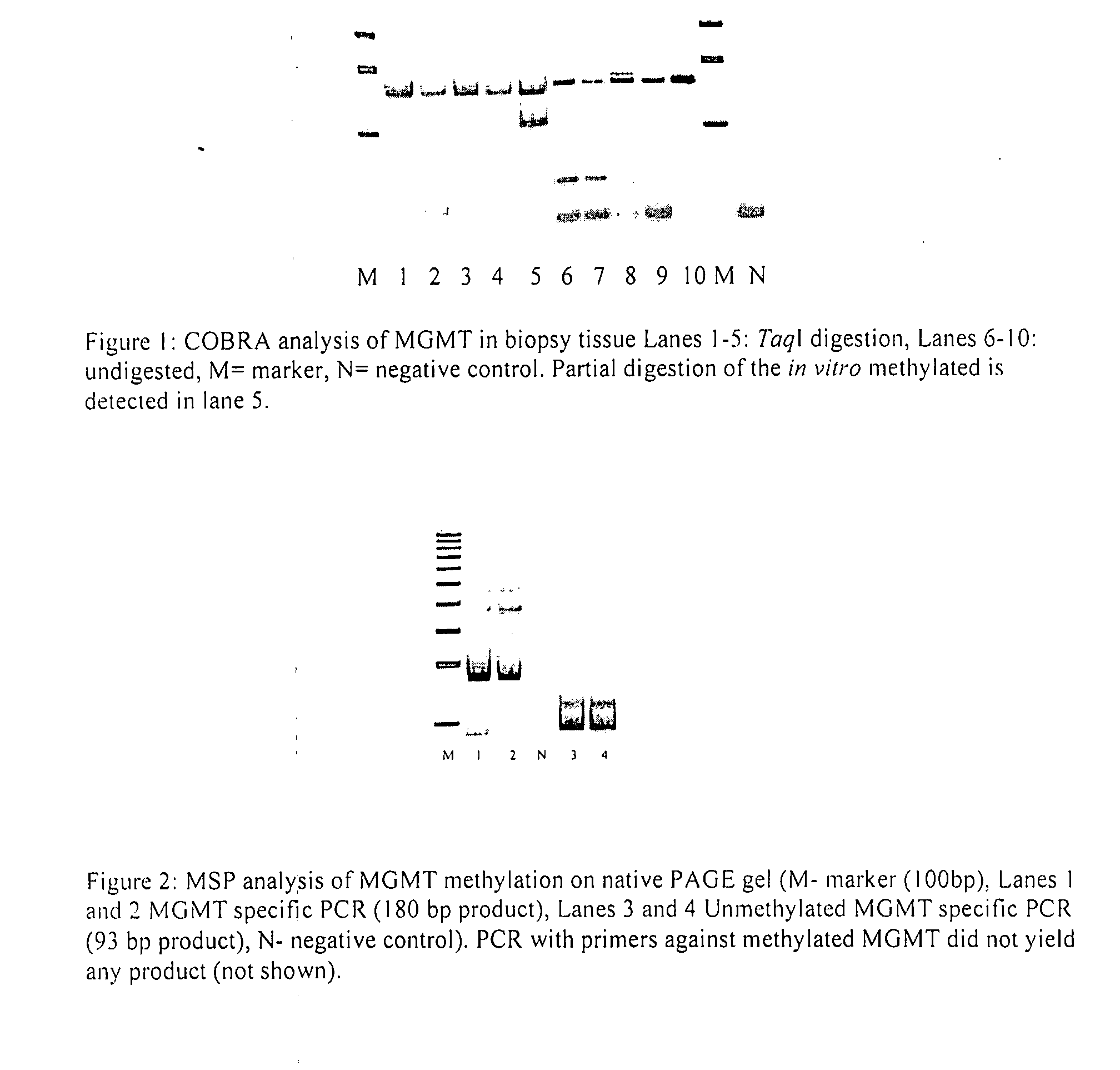 Method of monitoring colorectal cancer