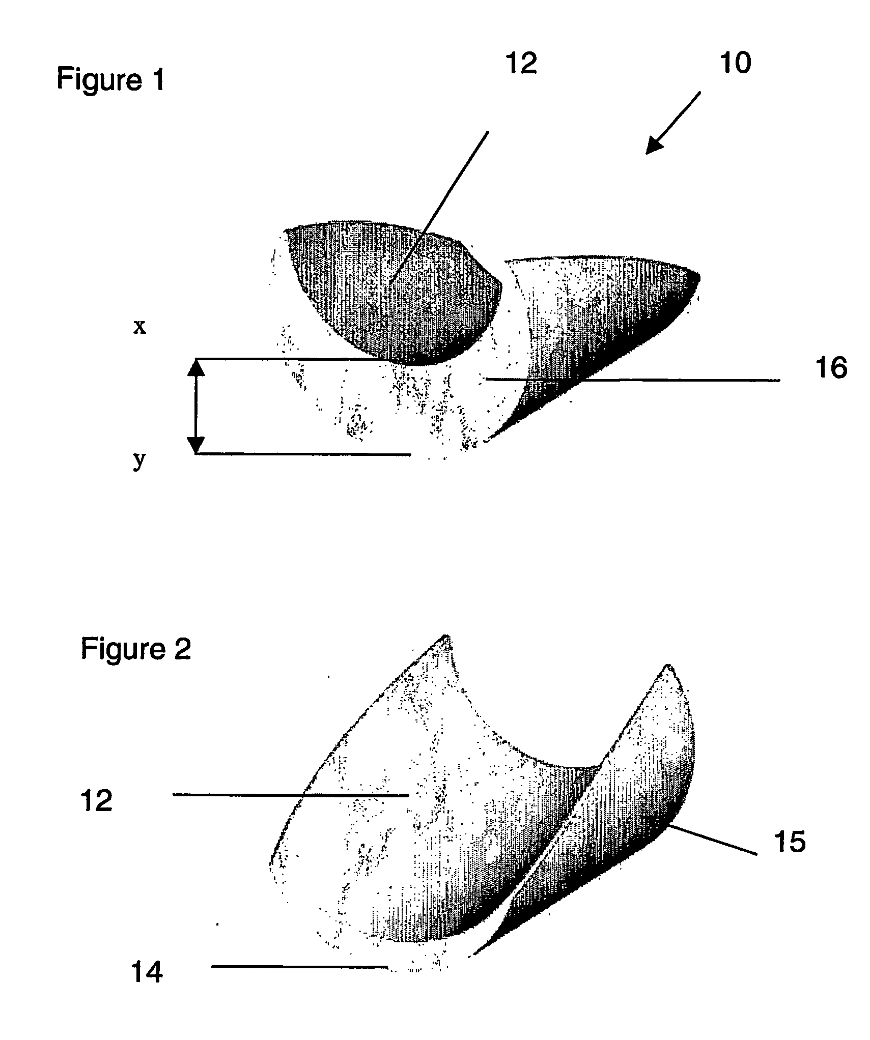 Hernia prosthesis