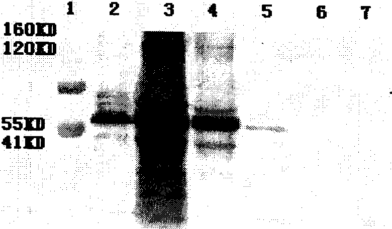 HIV-1 virus-like particle and its prepn and use