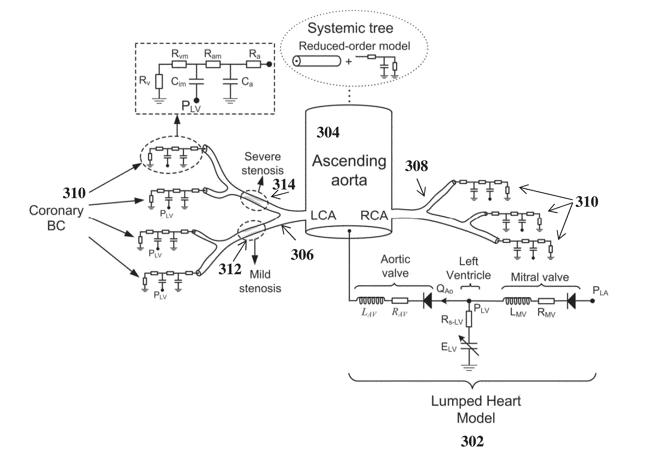 Method and System for Prediction of Post-Stenting Hemodynamic Metrics for Treatment Planning of Arterial Stenosis