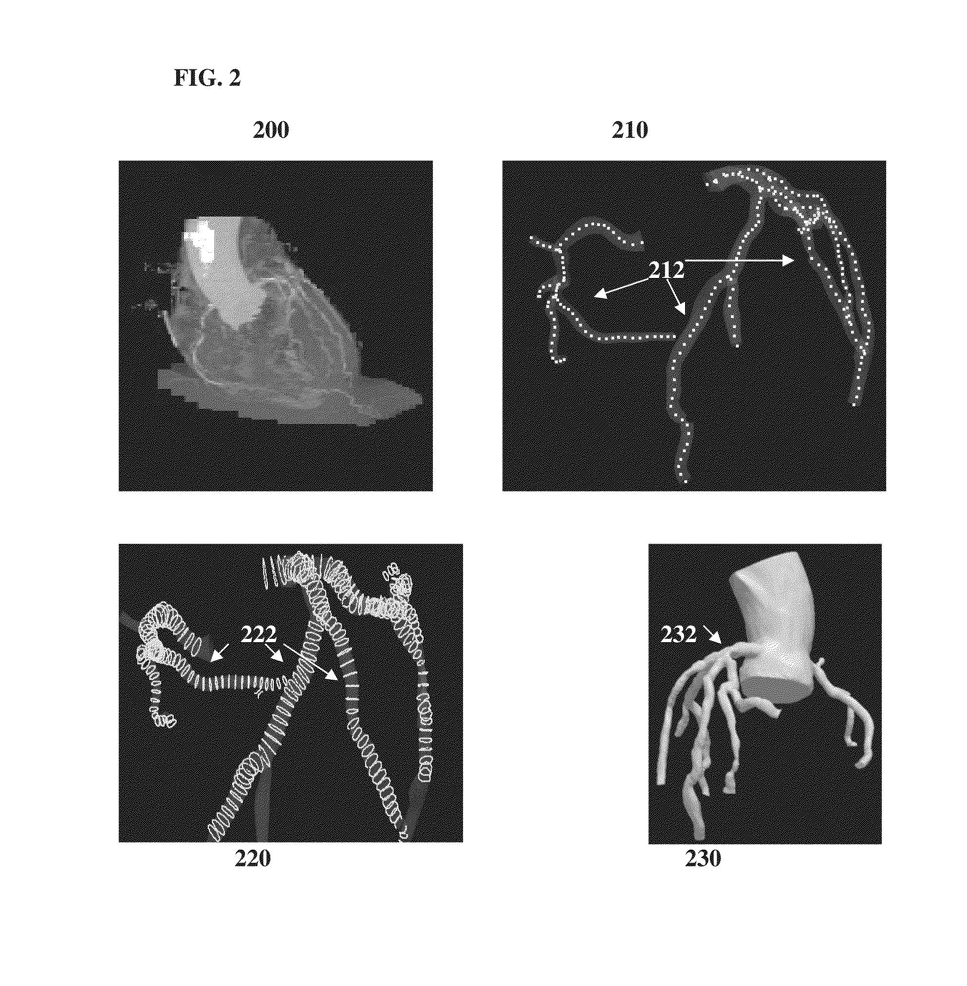 Method and System for Prediction of Post-Stenting Hemodynamic Metrics for Treatment Planning of Arterial Stenosis