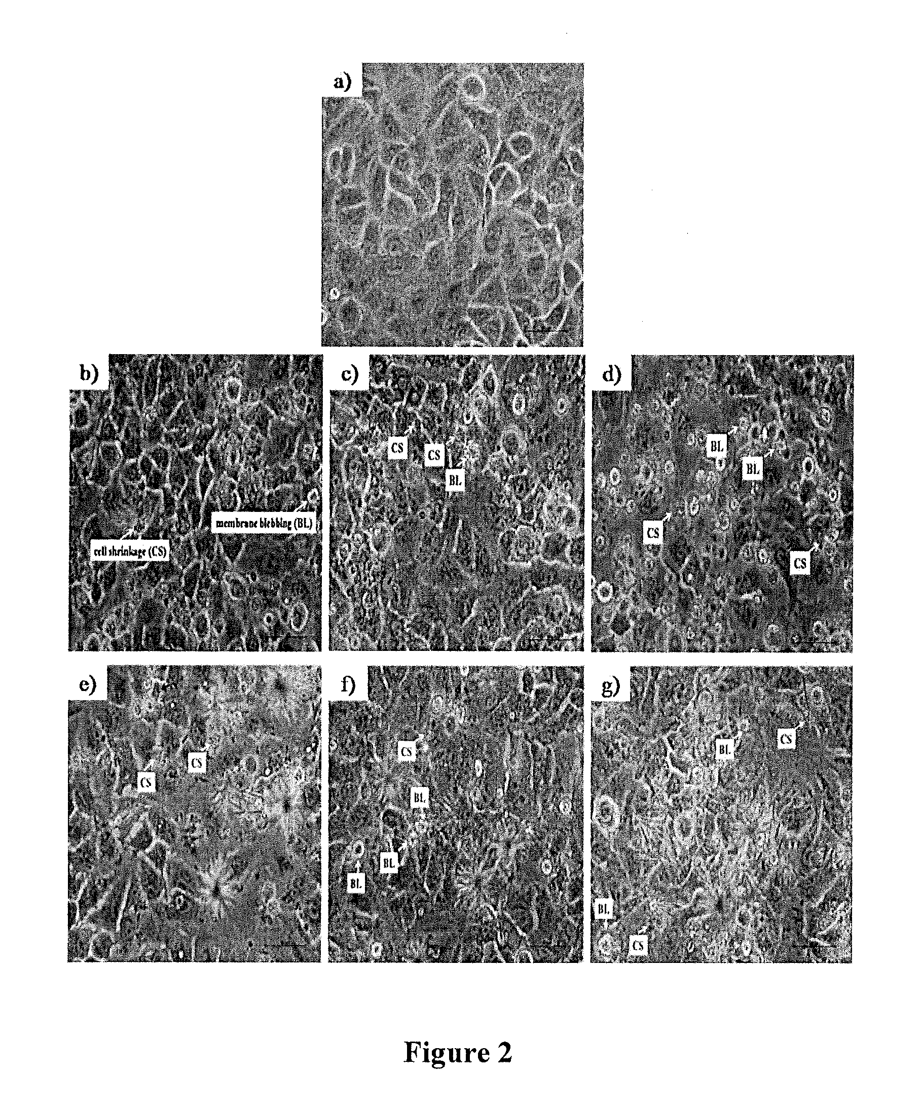 Methods and compositions for inhibiting cancer cell growth