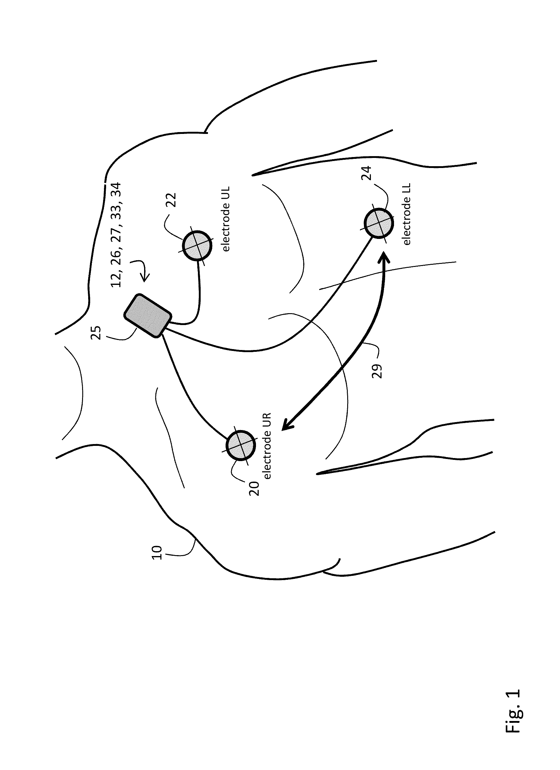 Body-worn monitor for measuring respiratory rate