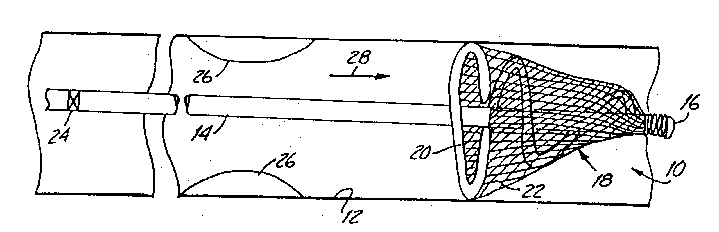 Distal protection device and method