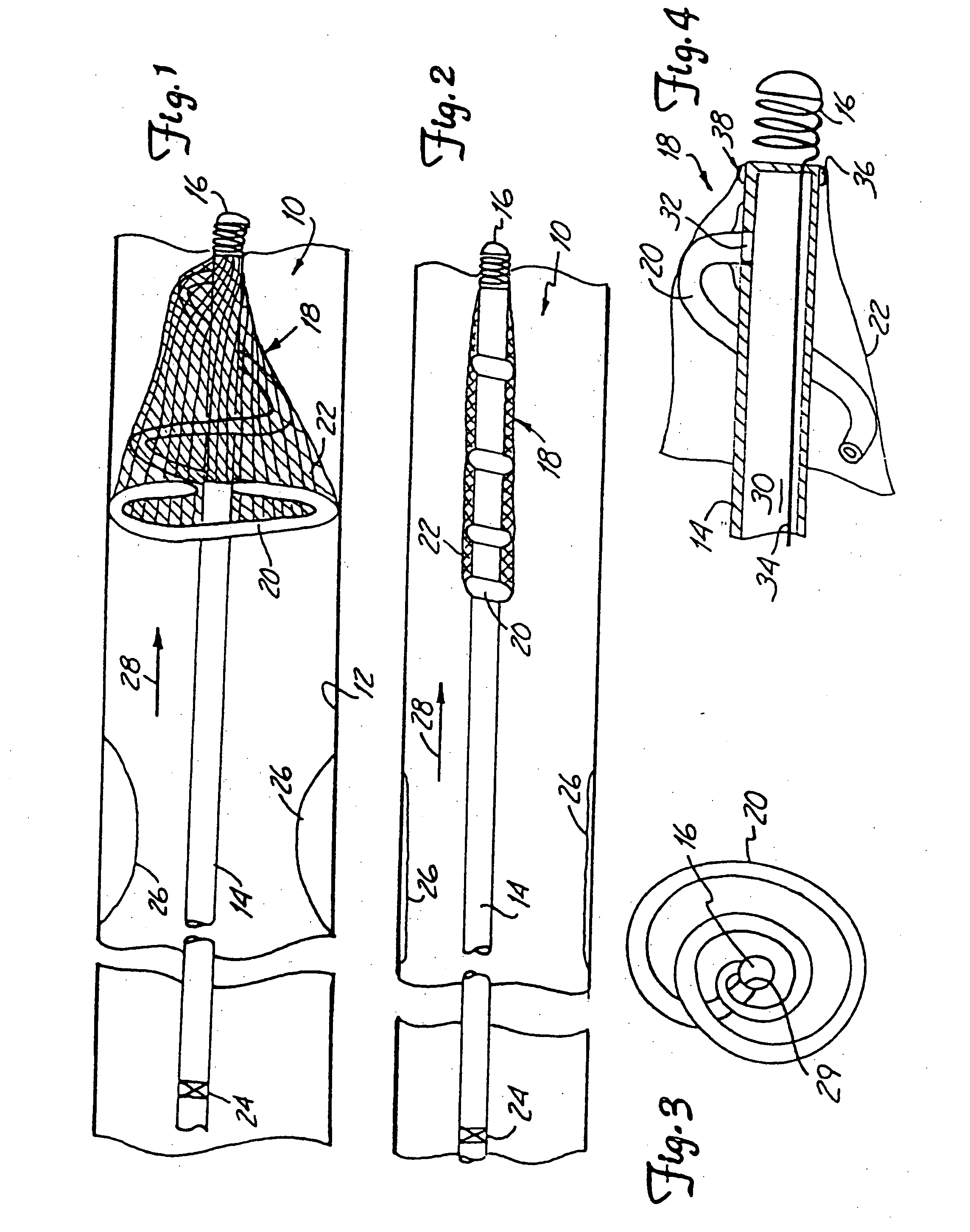 Distal protection device and method