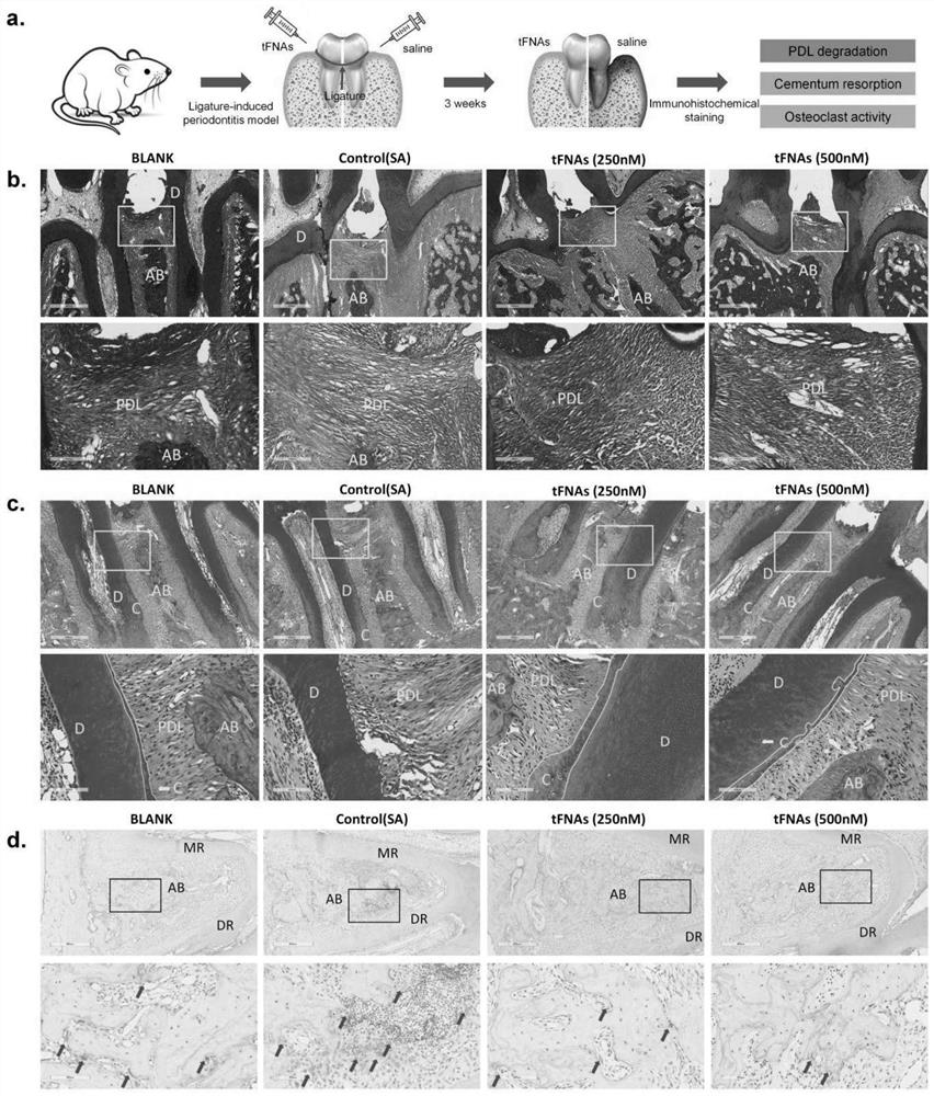 Application of DNA tetrahedron in preparation of medicine for treating and preventing periodontitis