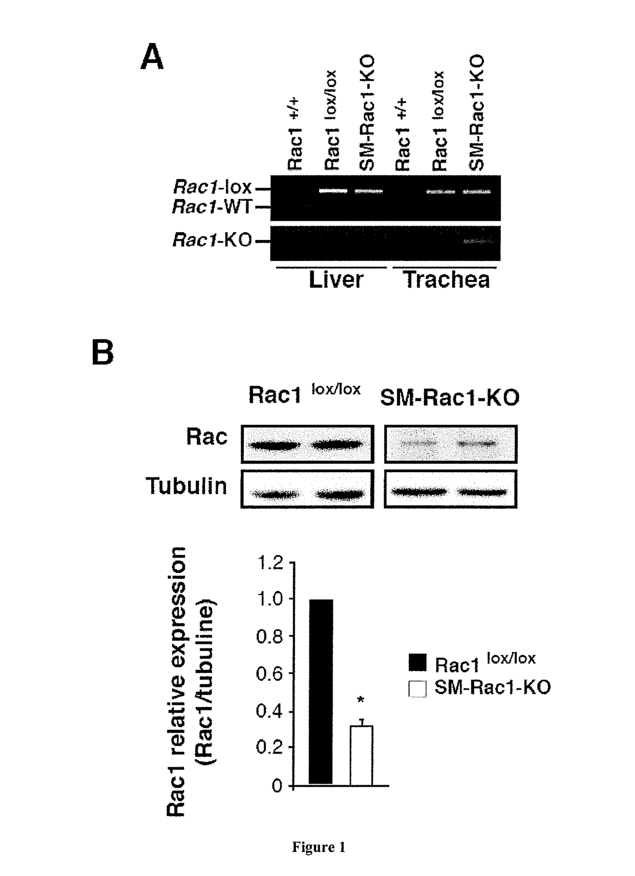 RAC1 inhibitors for inducing bronchodilation