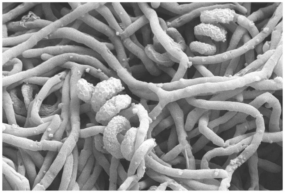 Actinomycetes with bacteriostatic activity and application thereof