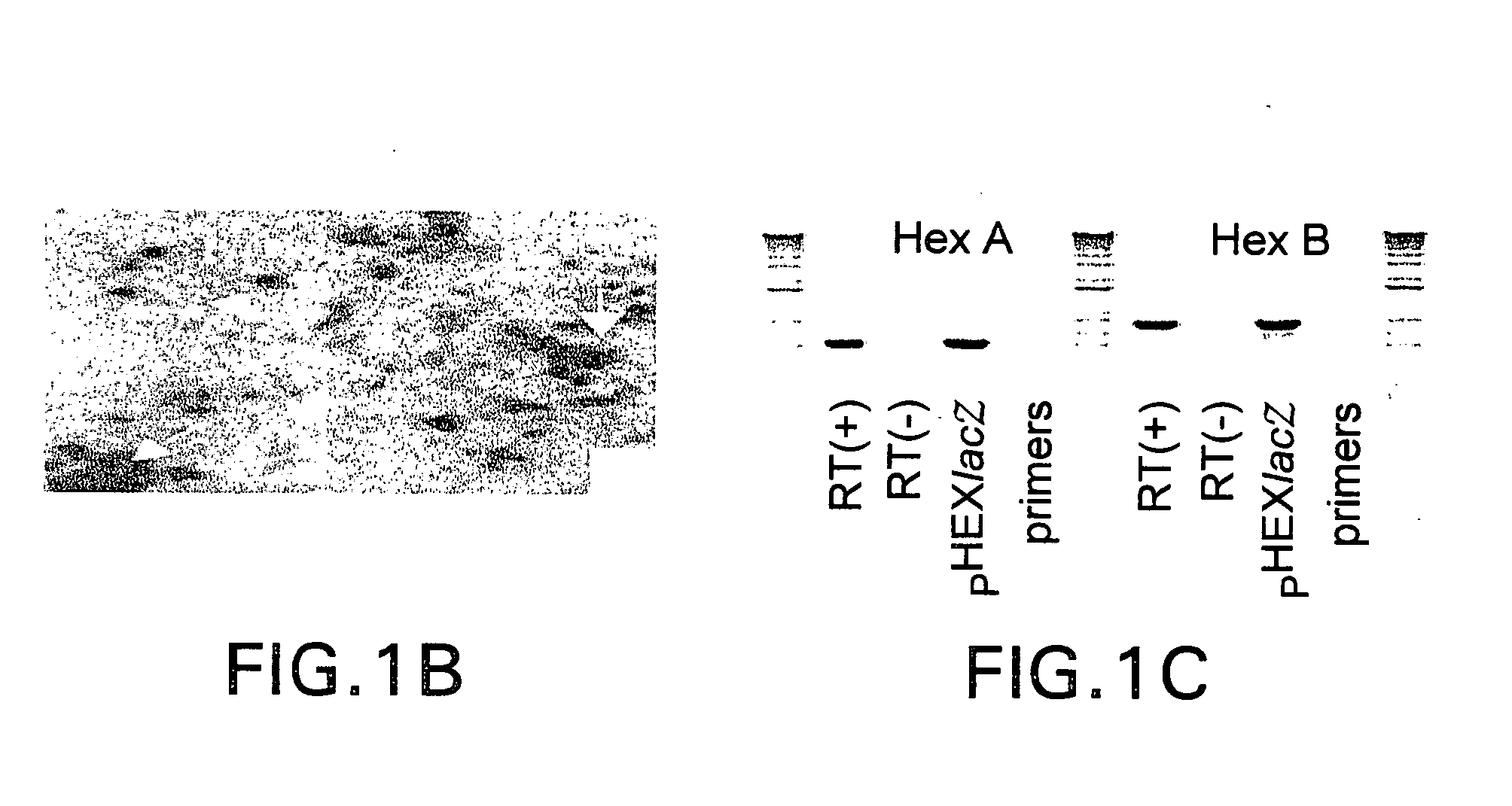 Vectors having both isoforms of beta-hexosaminidase and uses of the same