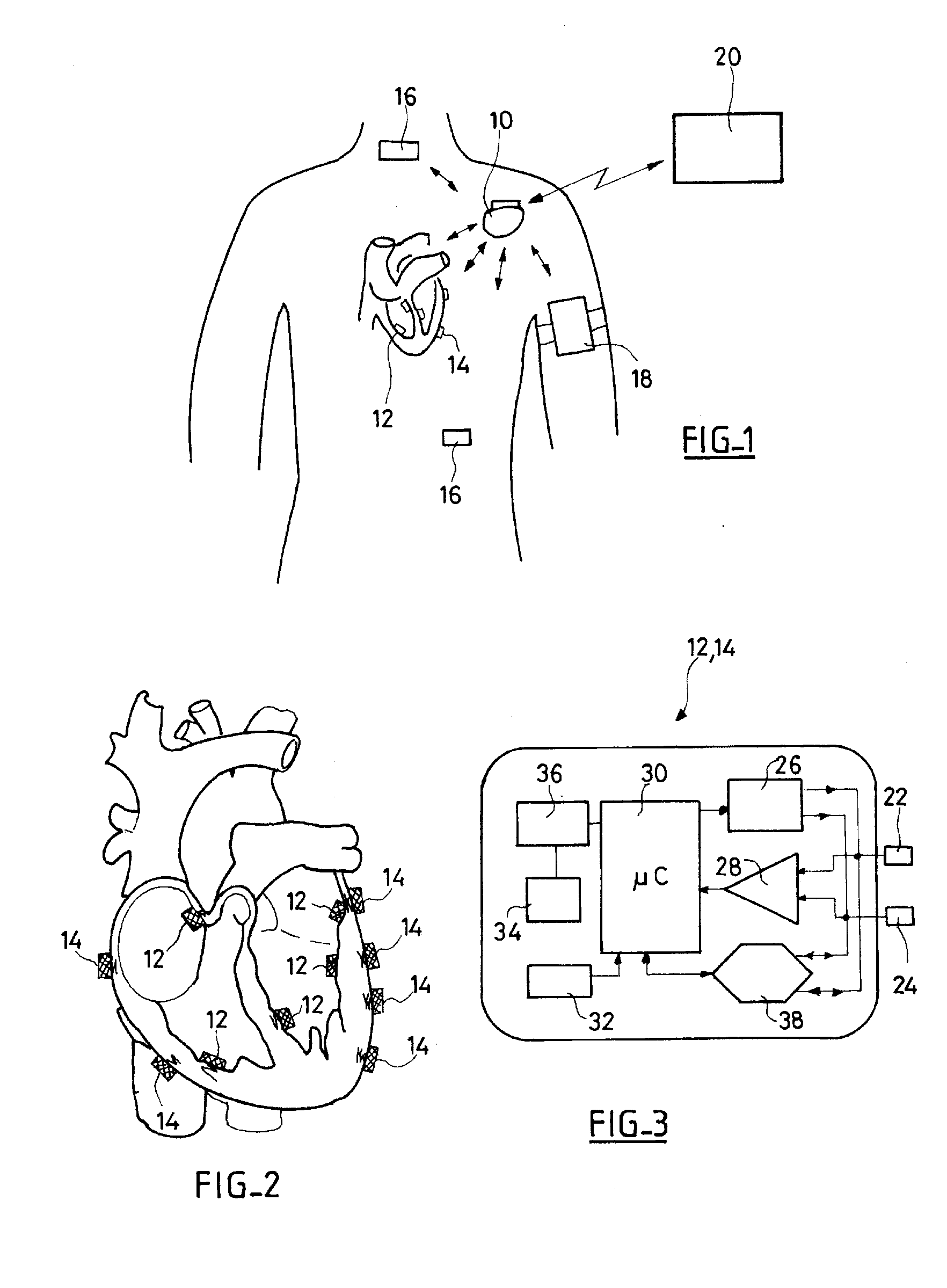 System, Methods And Apparatus For Waking An Autonomous Active Implantable Medical Device Communicating By Pulses Transmitted Through The Interstitial Tissues Of The Body