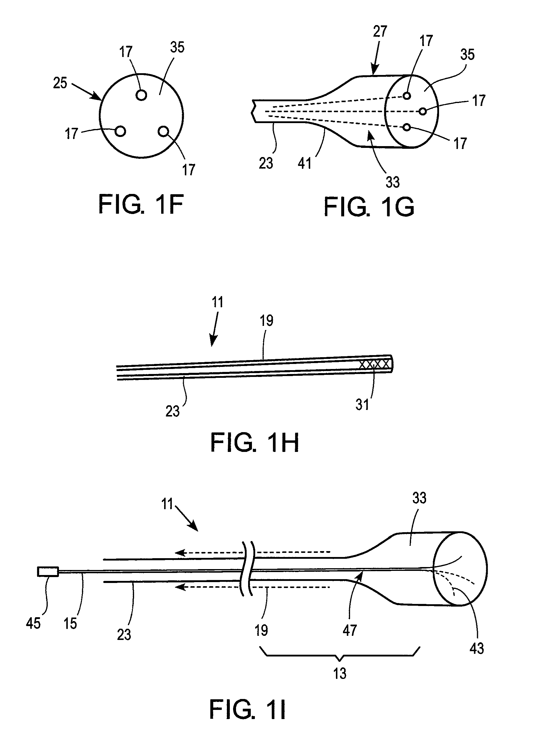 Catheter apparatus with telescoping lumen catheters and its use in methods for treating vasculatures