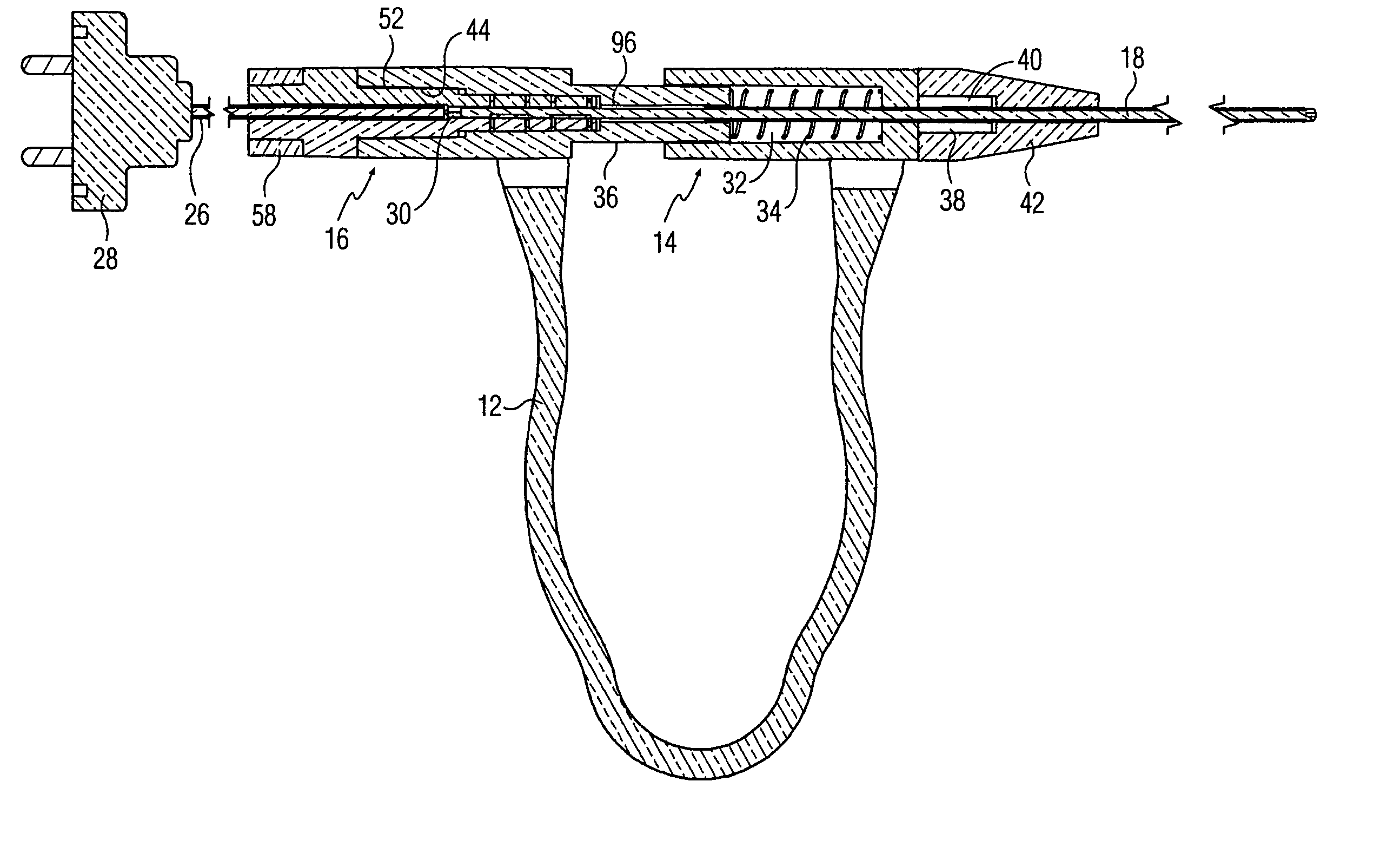 Disposable electrosurgical handpiece for treating tissue