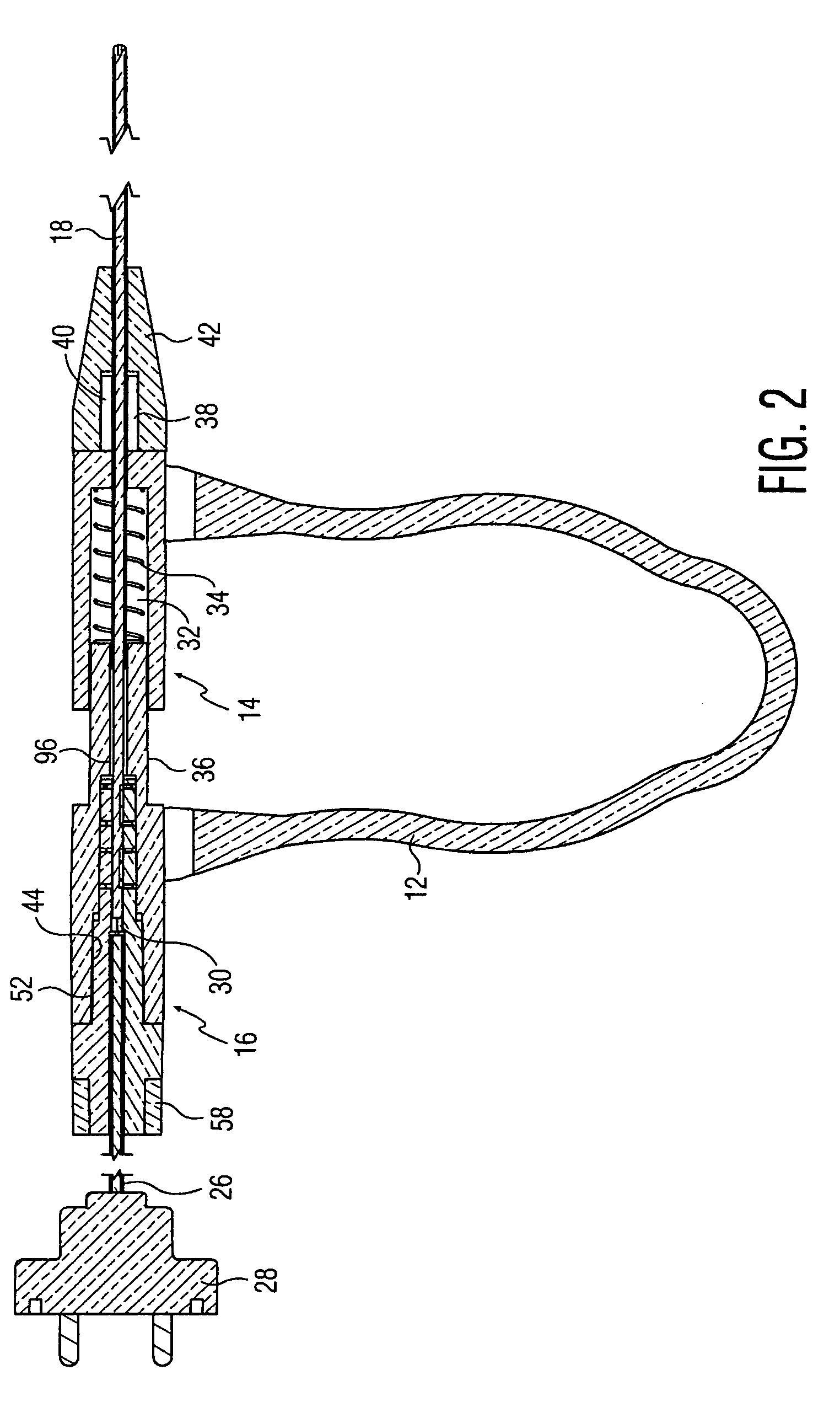 Disposable electrosurgical handpiece for treating tissue