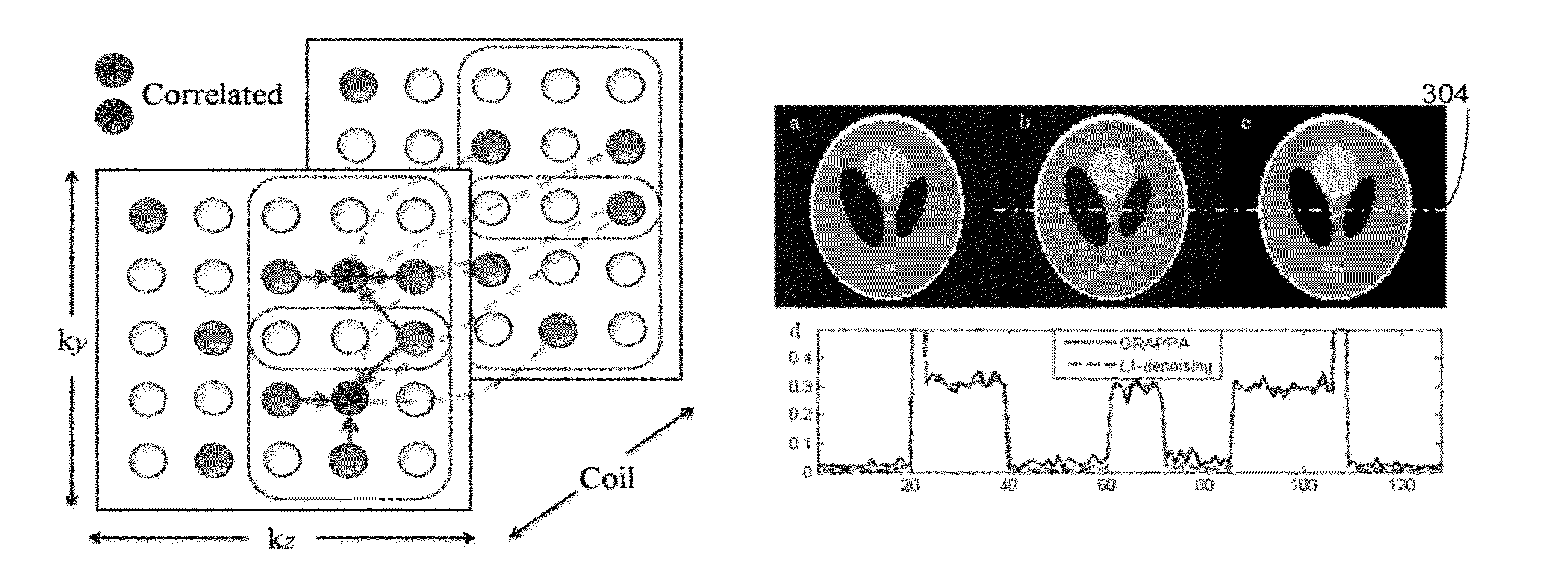 Method of autocalibrating parallel imaging interpolation from arbitrary K-space sampling with noise correlations weighted to reduce noise of reconstructed images