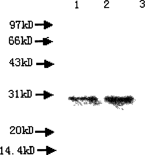 Fusion expression method of mycobacterium tuberculosis ESAT-6 protein in pichia